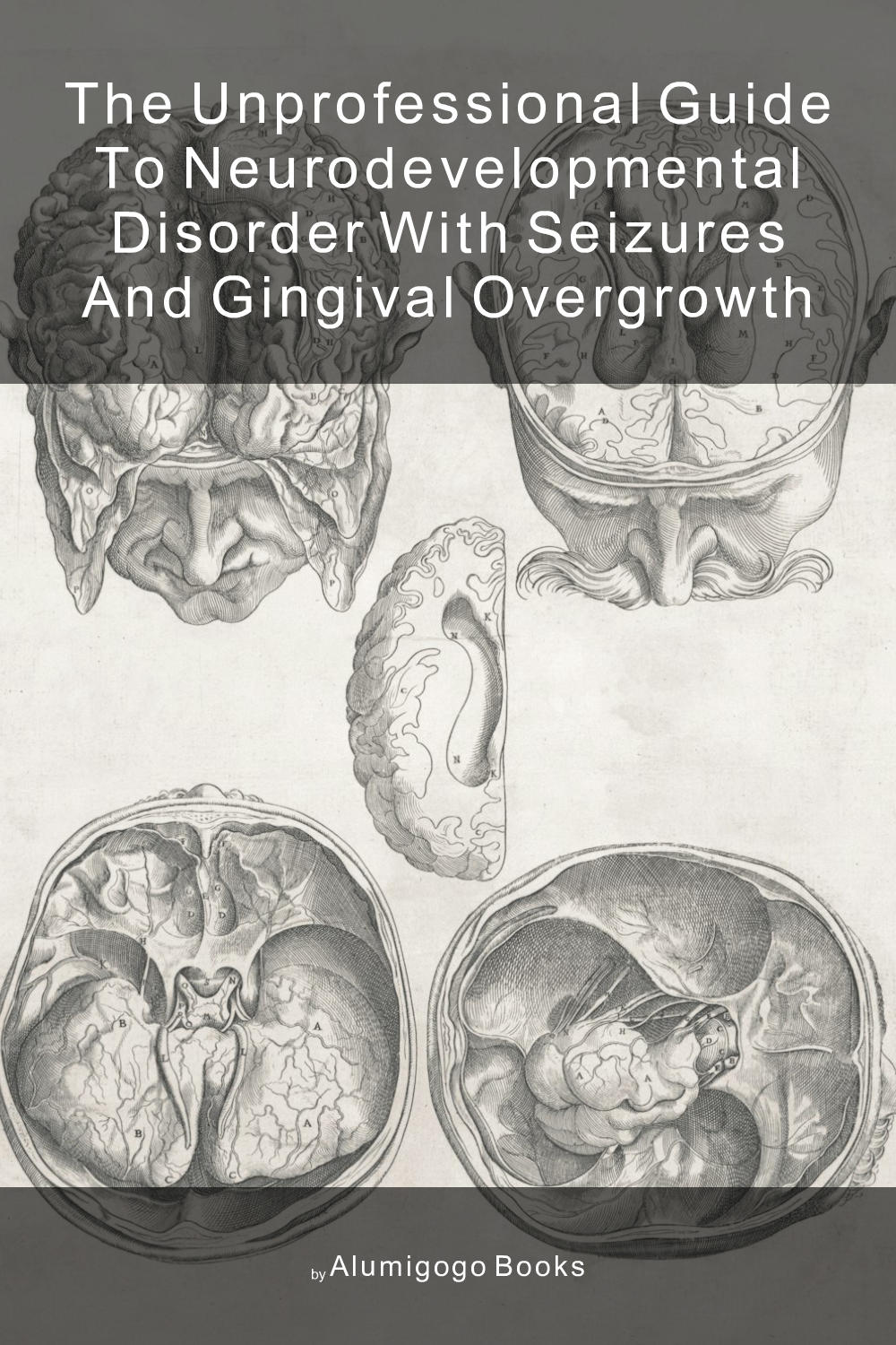 Cover of The Unprofessional Guide to neurodevelopmental disorder with seizures and gingival overgrowth