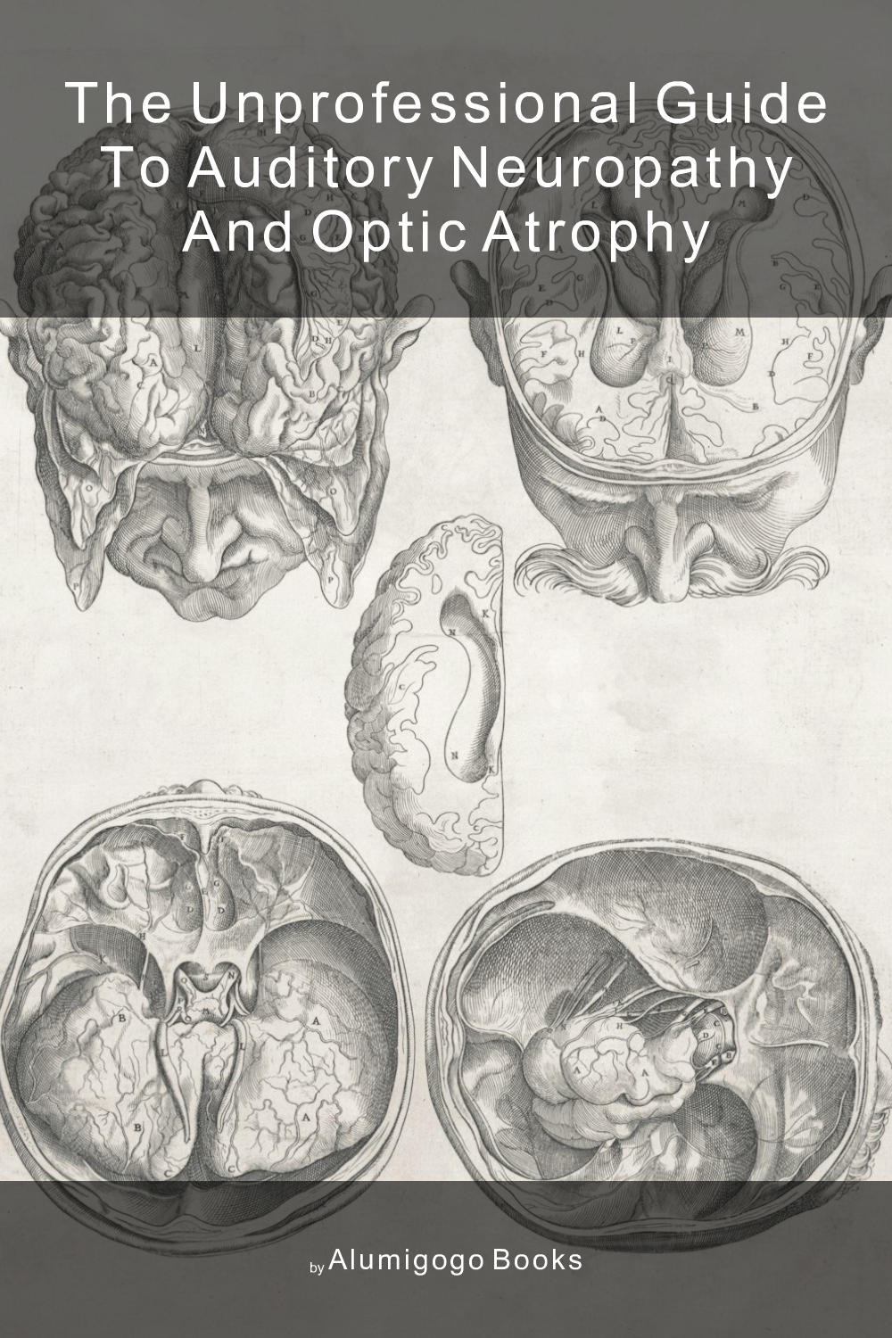 Cover of The Unprofessional Guide to auditory neuropathy and optic atrophy
