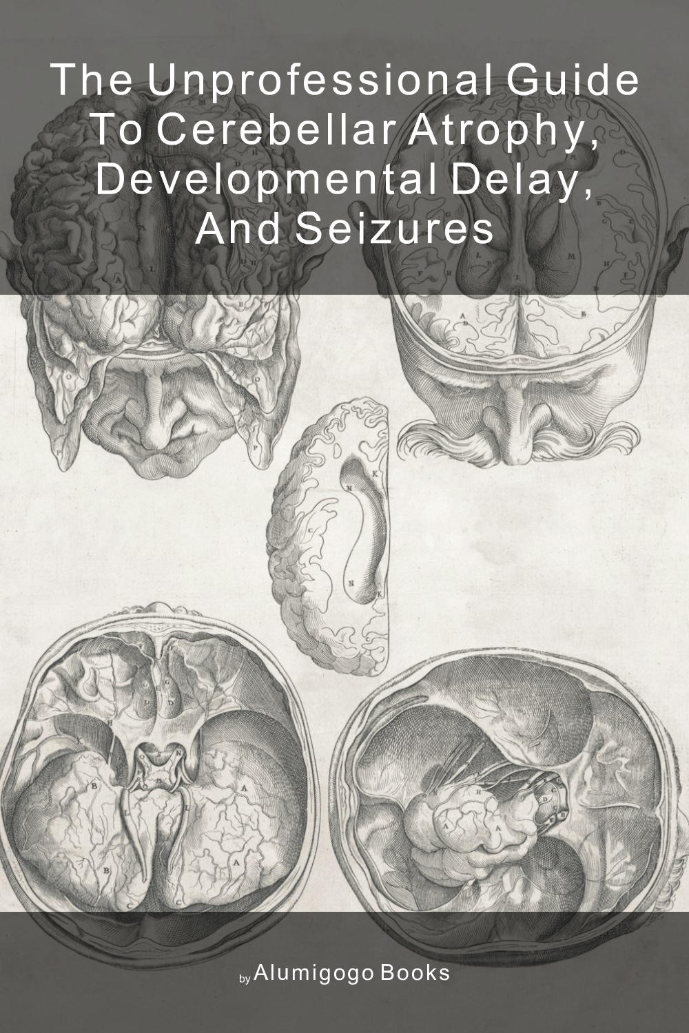 Cover of The Unprofessional Guide to cerebellar atrophy, developmental delay, and seizures