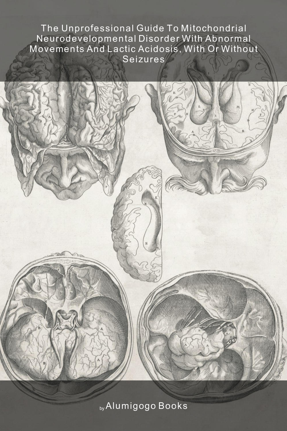Cover of The Unprofessional Guide to mitochondrial neurodevelopmental disorder with abnormal movements and lactic acidosis, with or without seizures