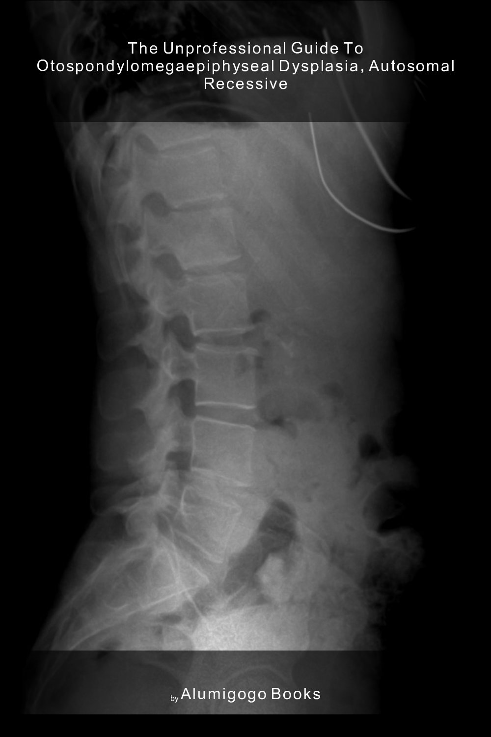 Cover of The Unprofessional Guide to otospondylomegaepiphyseal dysplasia, autosomal recessive