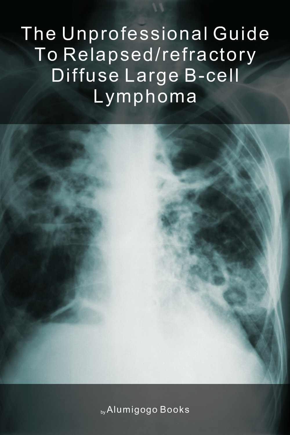Cover of The Unprofessional Guide to relapsed/refractory diffuse large B-cell lymphoma