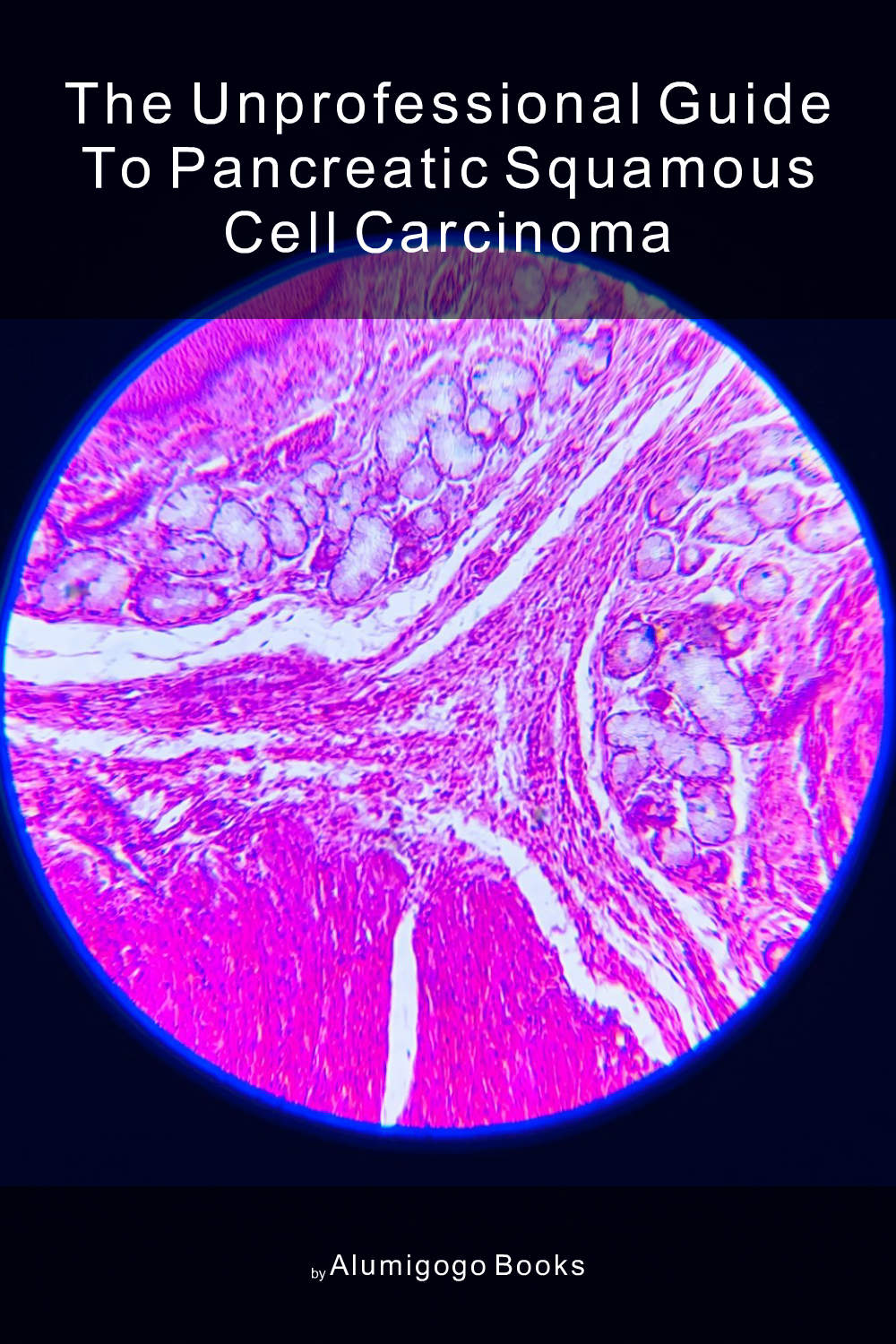 Cover of The Unprofessional Guide to pancreatic squamous cell carcinoma