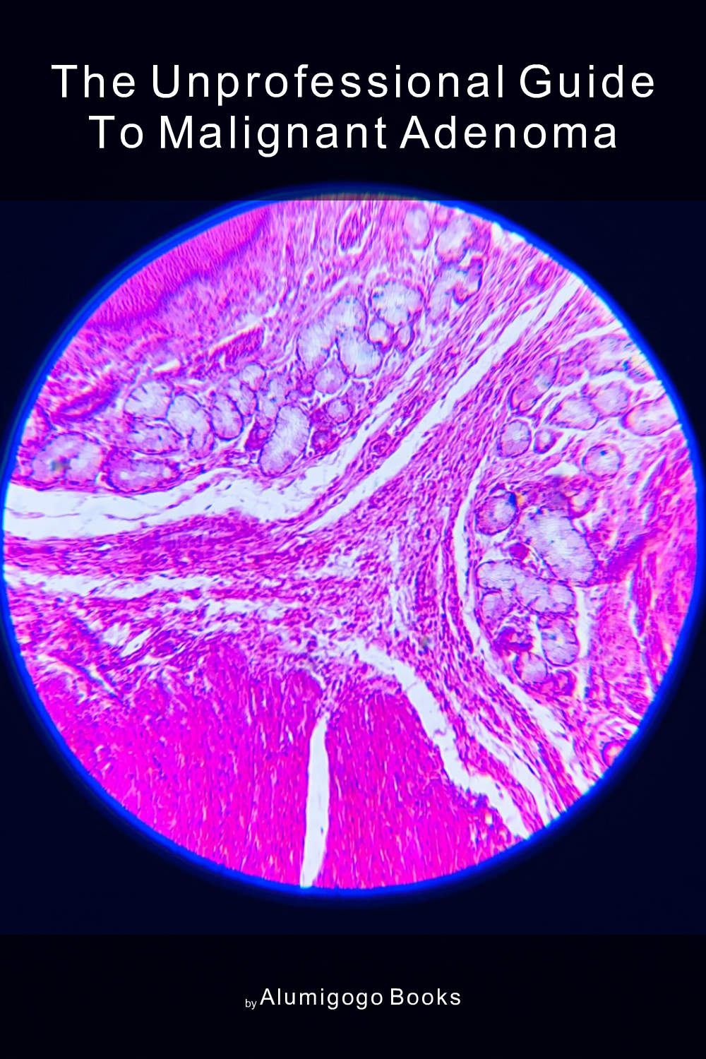 Cover of The Unprofessional Guide to malignant adenoma