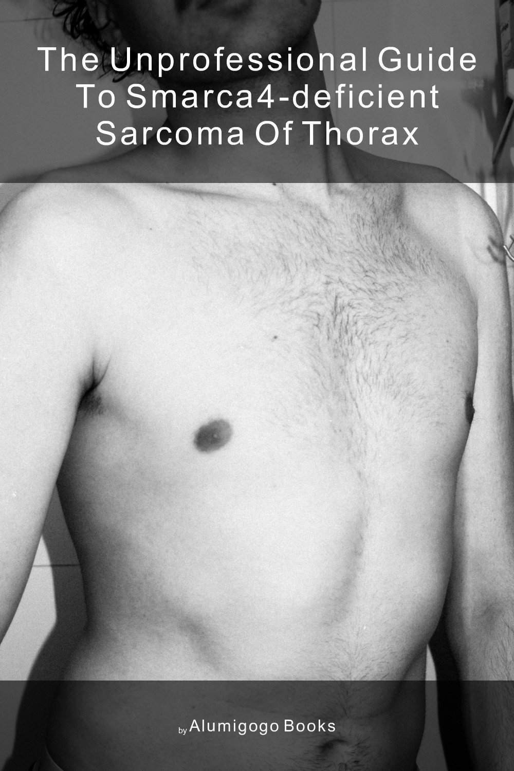 Cover of The Unprofessional Guide to Smarca4-deficient sarcoma of thorax
