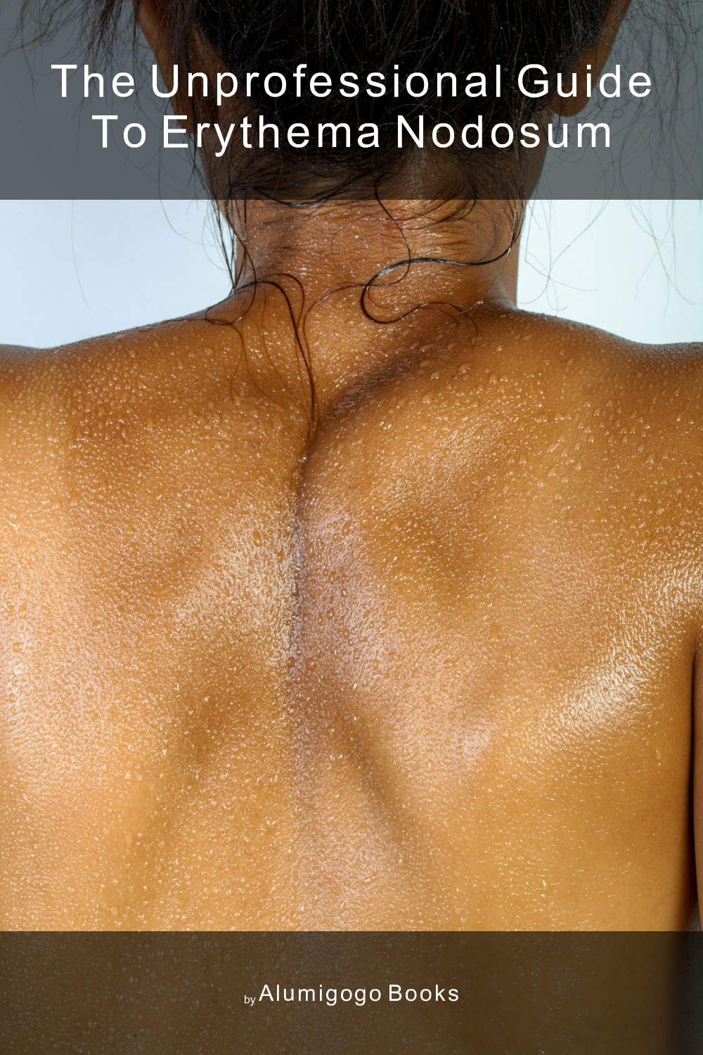 Cover of The Unprofessional Guide to erythema nodosum
