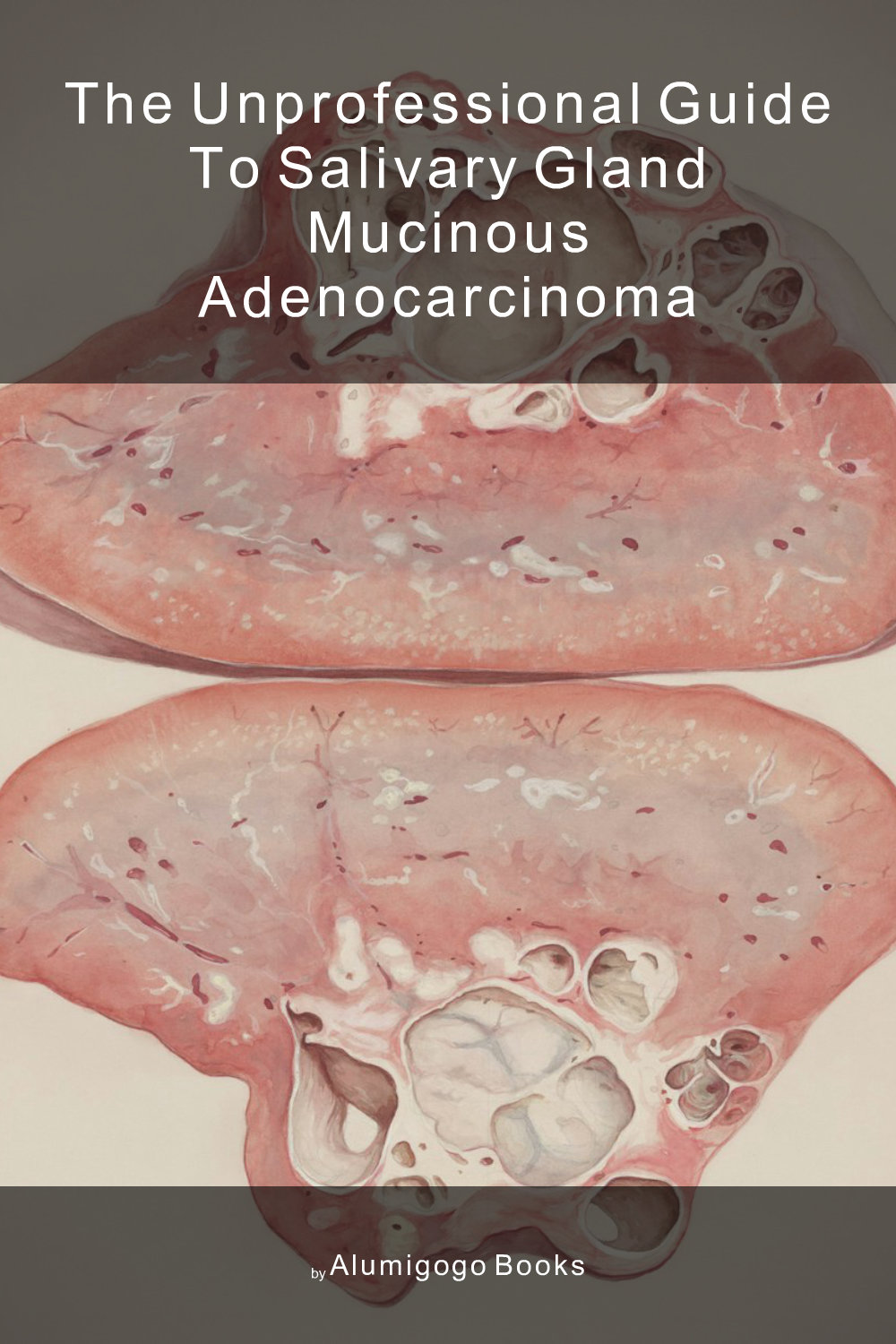 Cover of The Unprofessional Guide to salivary gland mucinous adenocarcinoma