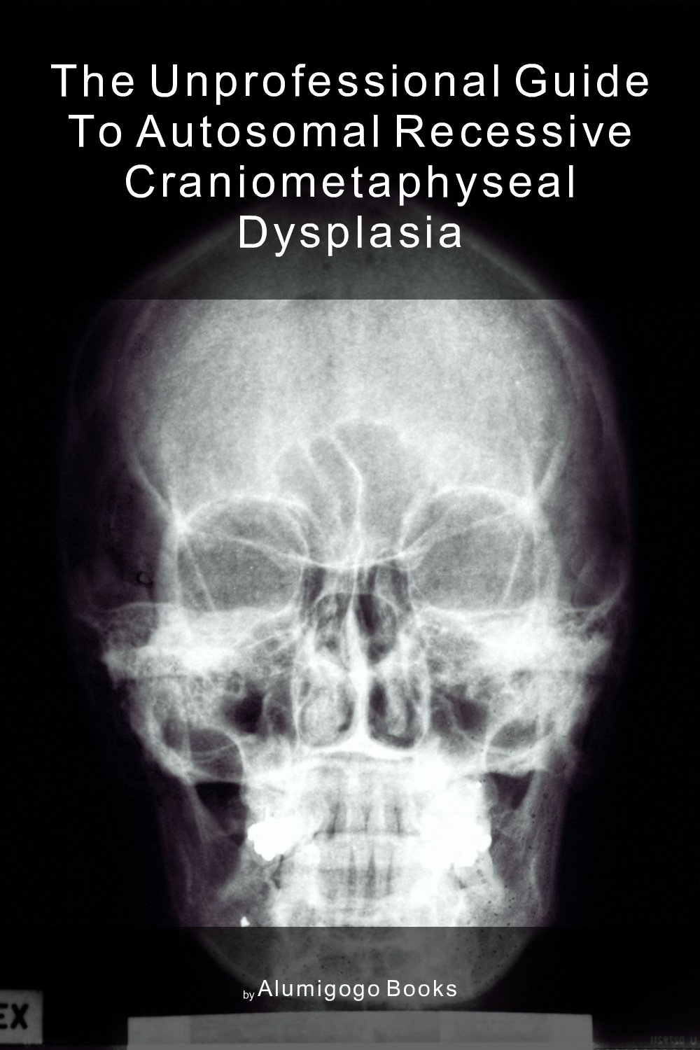 Cover of The Unprofessional Guide to autosomal recessive craniometaphyseal dysplasia