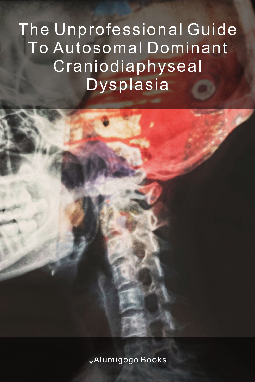Cover of The Unprofessional Guide to autosomal dominant craniodiaphyseal dysplasia