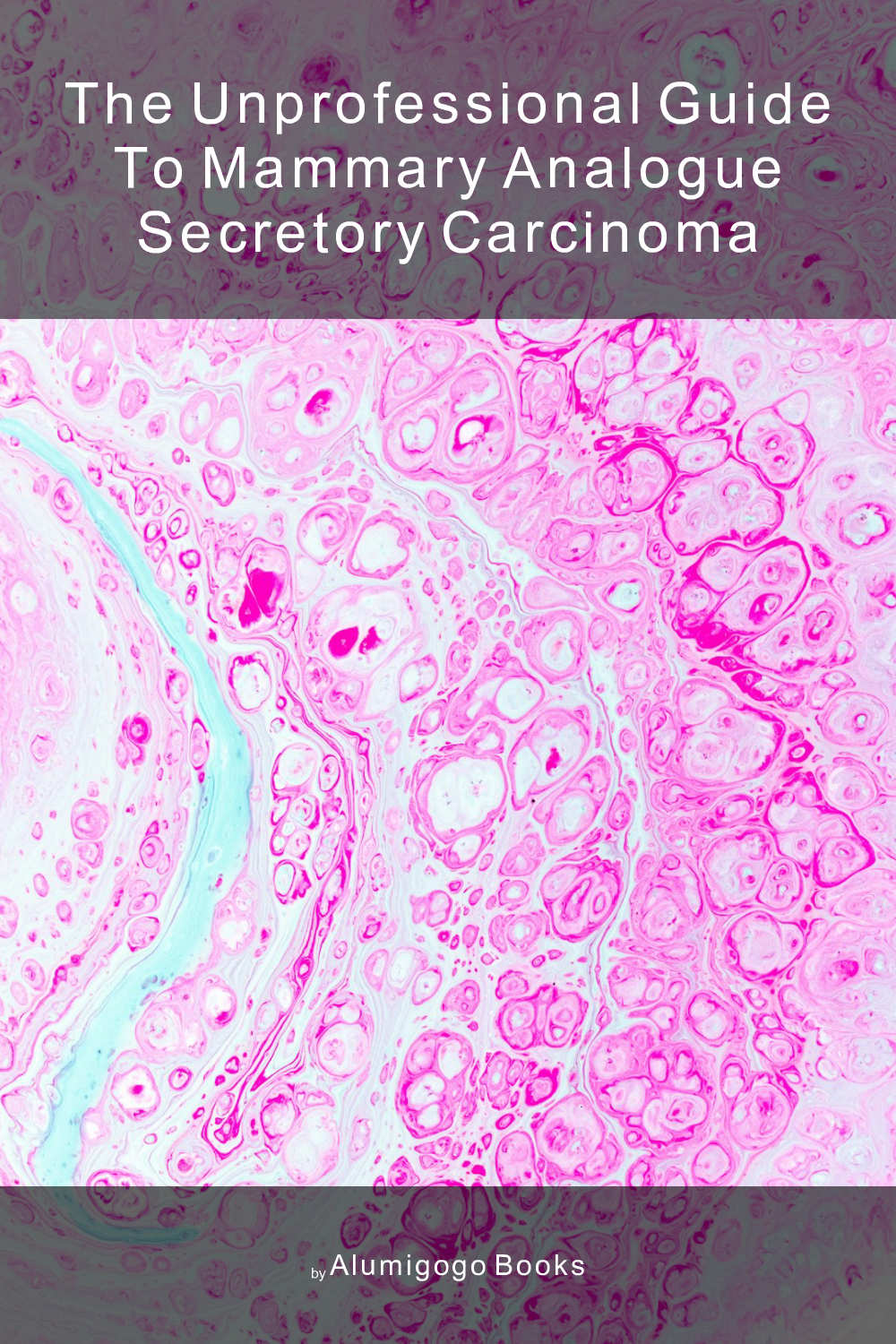 Cover of The Unprofessional Guide to mammary analogue secretory carcinoma