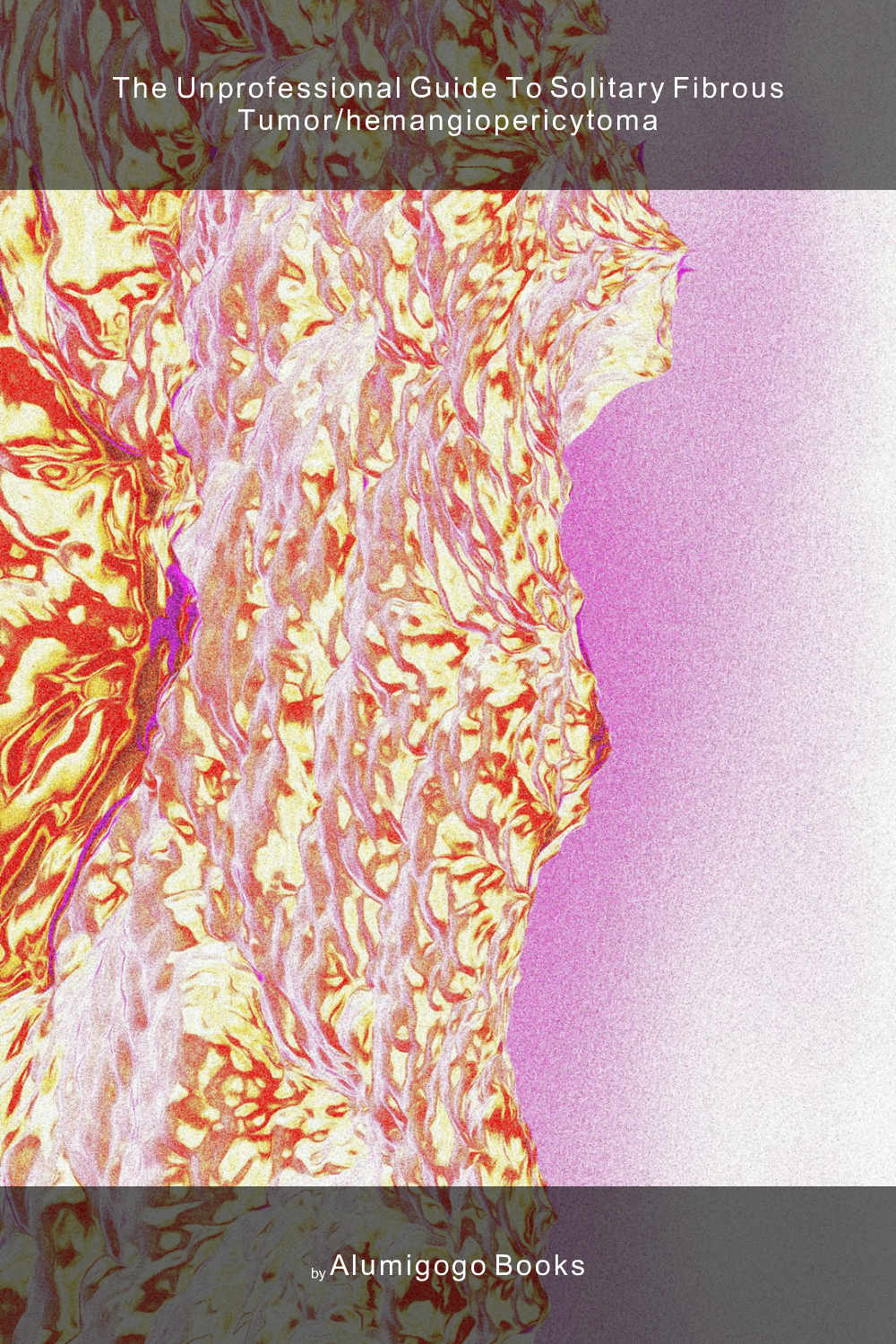 Cover of The Unprofessional Guide to solitary fibrous tumor/hemangiopericytoma