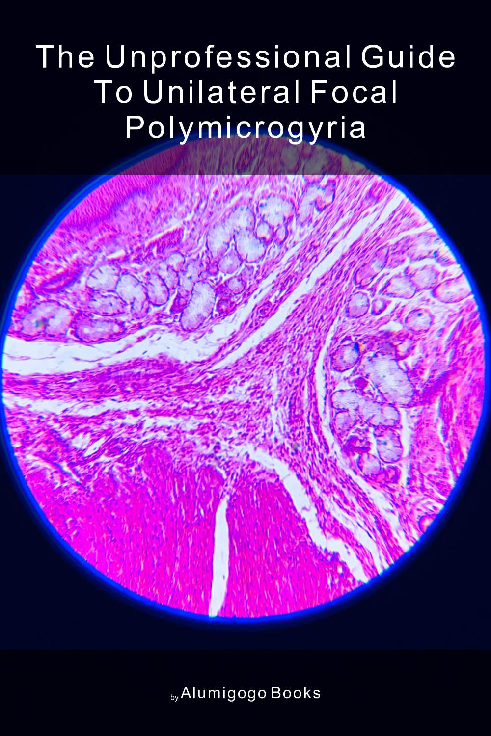 Cover of The Unprofessional Guide to unilateral focal polymicrogyria