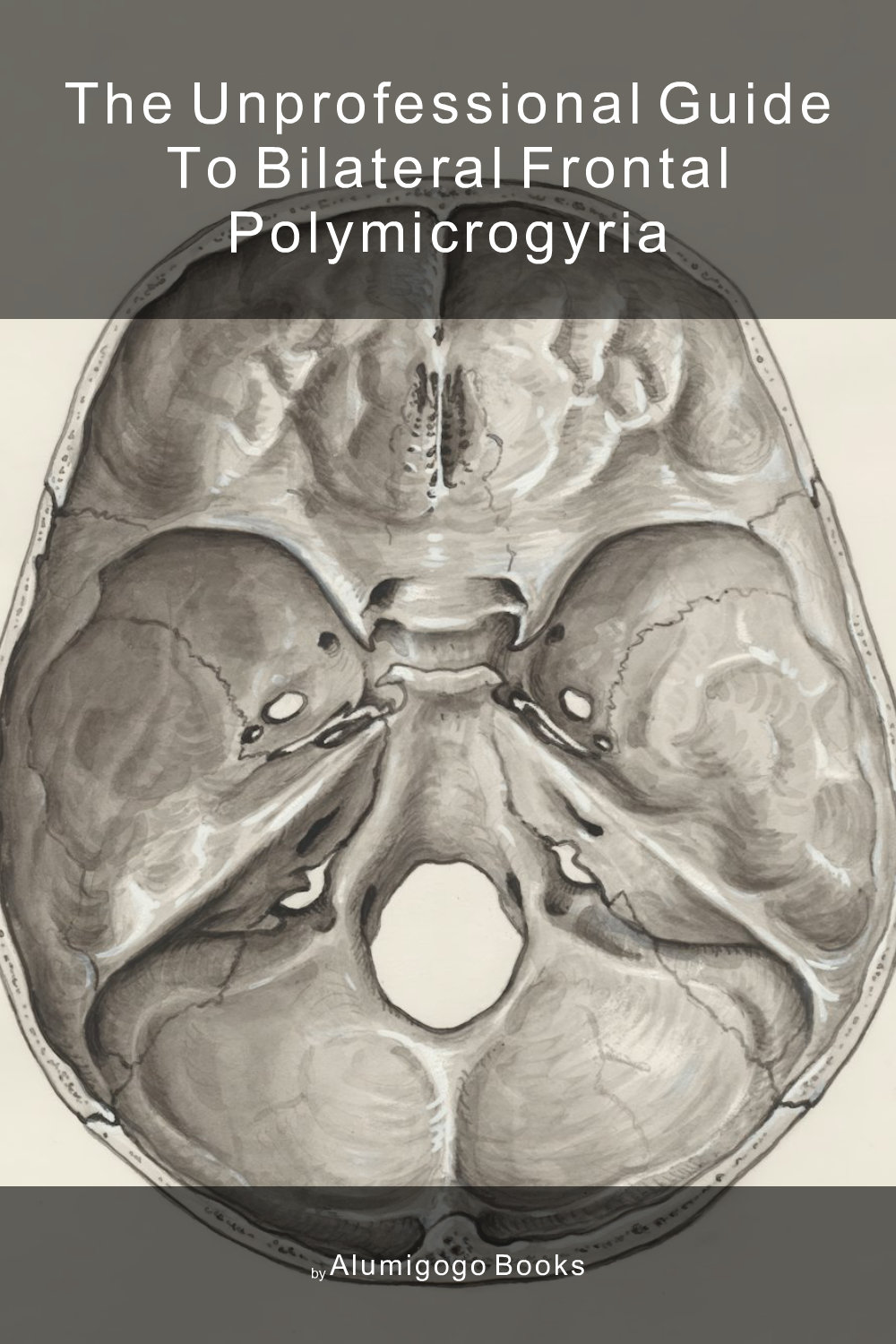 Cover of The Unprofessional Guide to bilateral frontal polymicrogyria