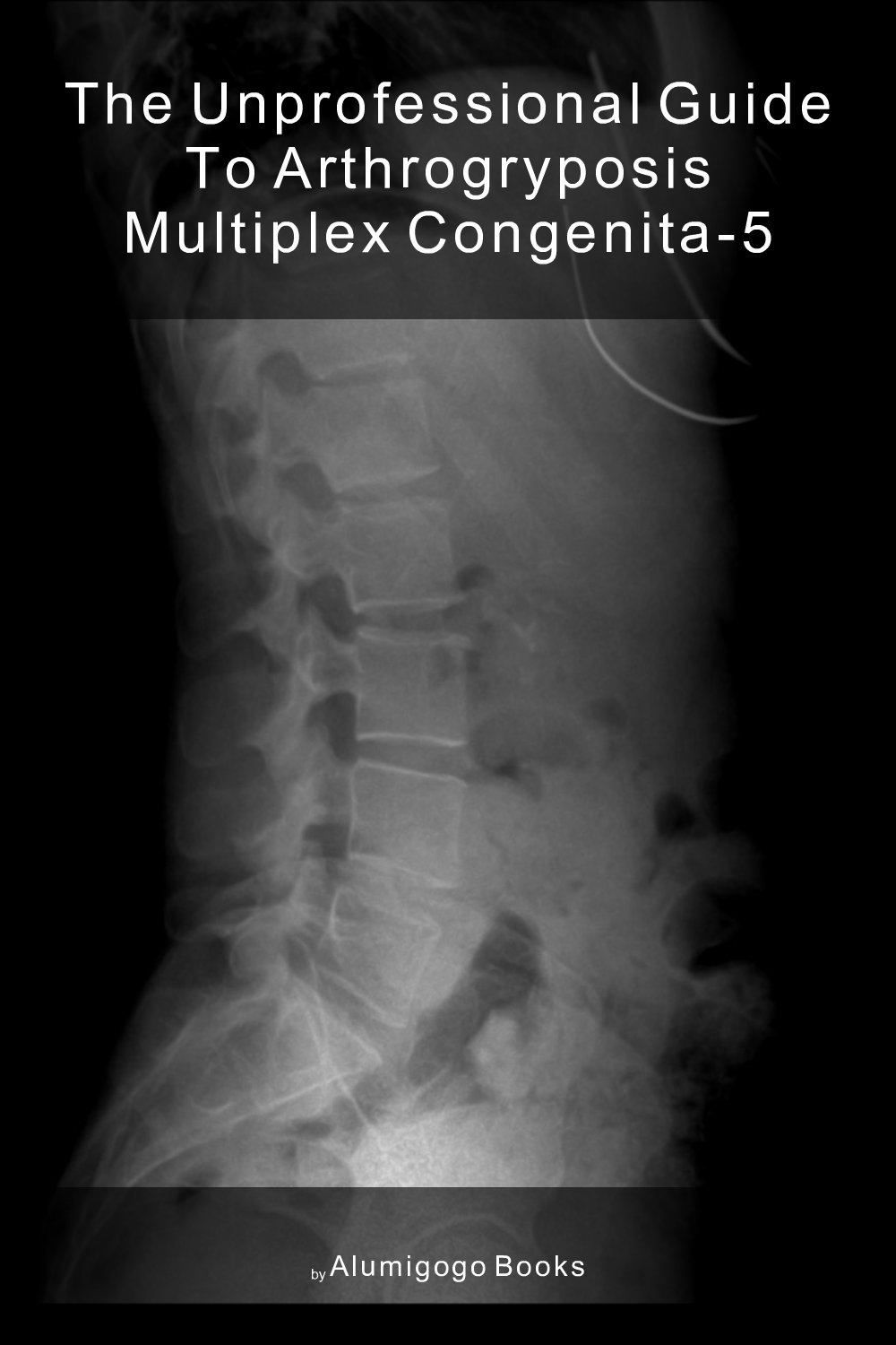 Cover of The Unprofessional Guide to arthrogryposis multiplex congenita-5