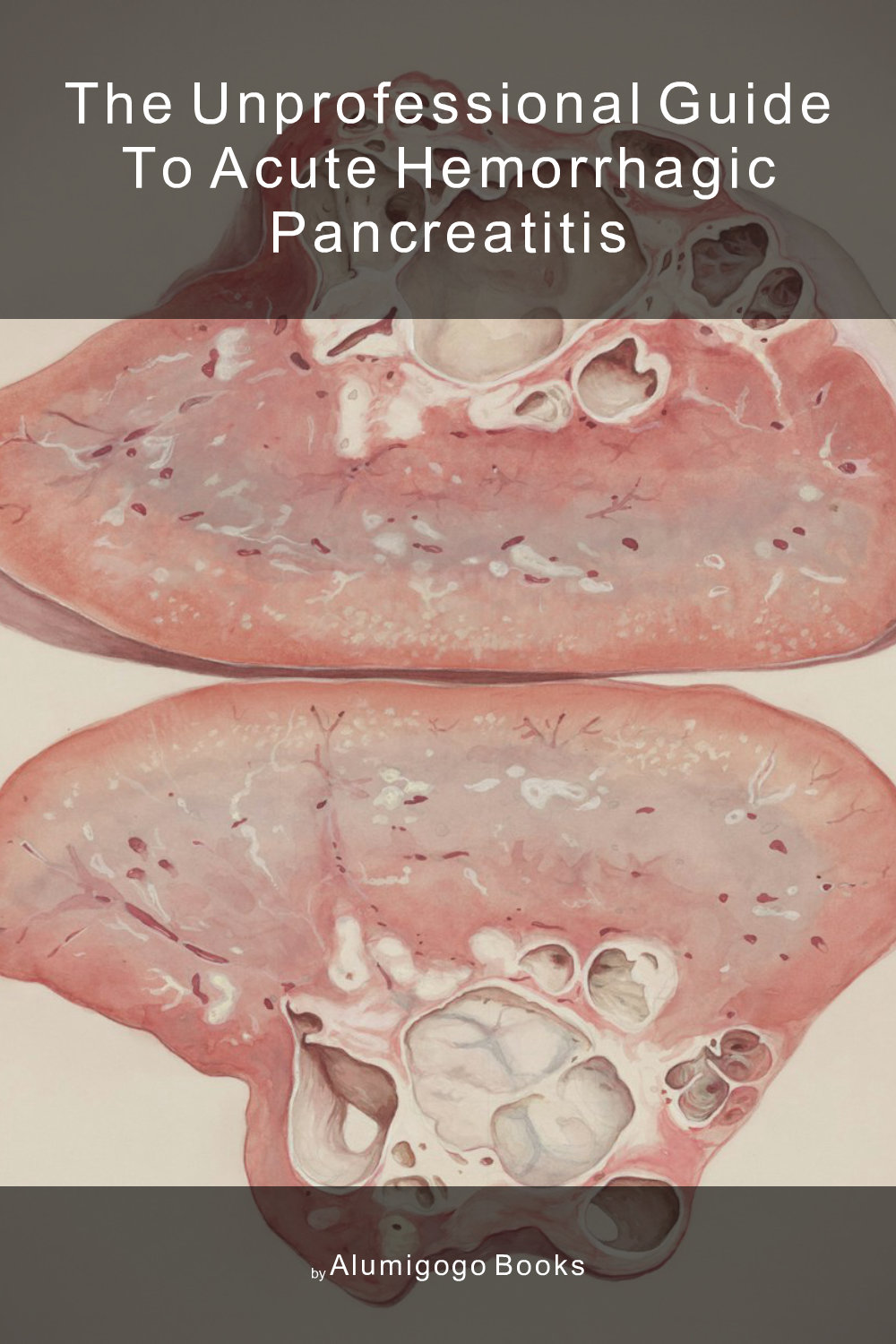 Cover of The Unprofessional Guide to acute hemorrhagic pancreatitis