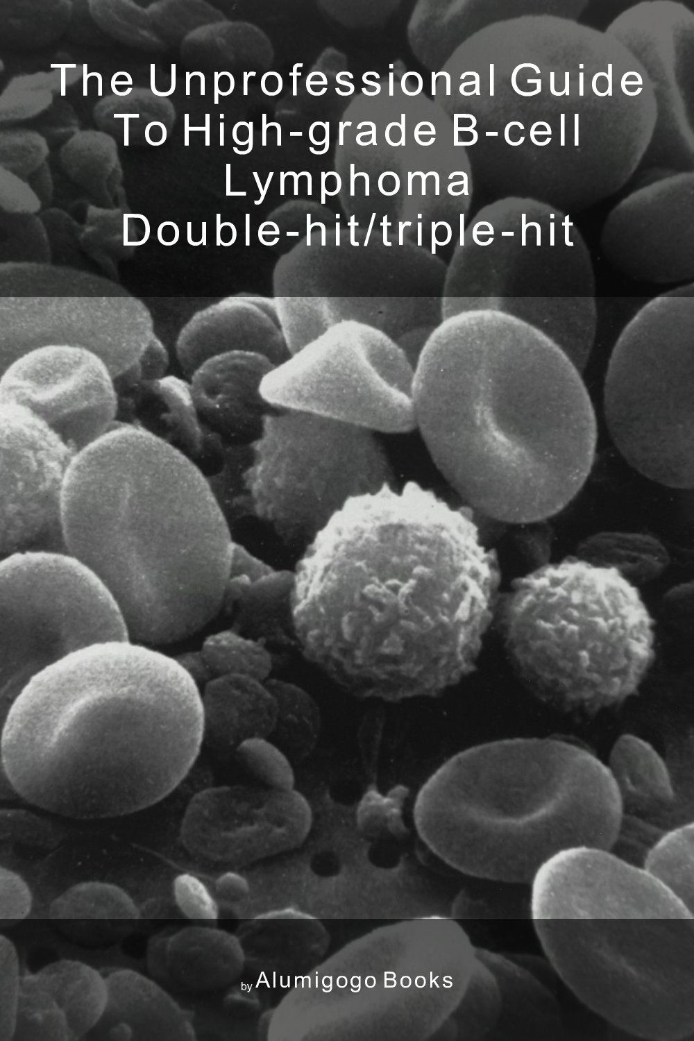 Cover of The Unprofessional Guide to high-grade B-cell lymphoma double-hit/triple-hit