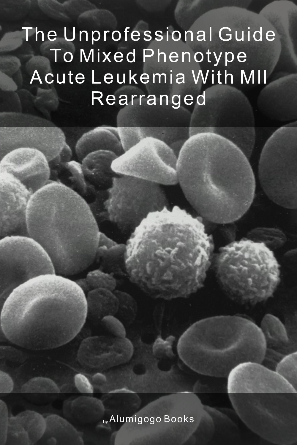 Cover of The Unprofessional Guide to mixed phenotype acute leukemia with MLL rearranged