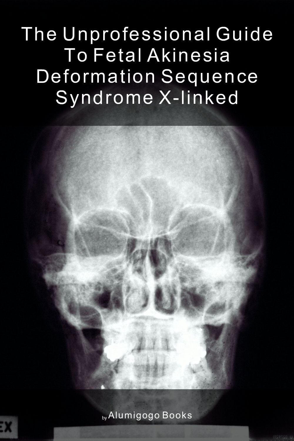 Cover of The Unprofessional Guide to fetal akinesia deformation sequence syndrome X-linked
