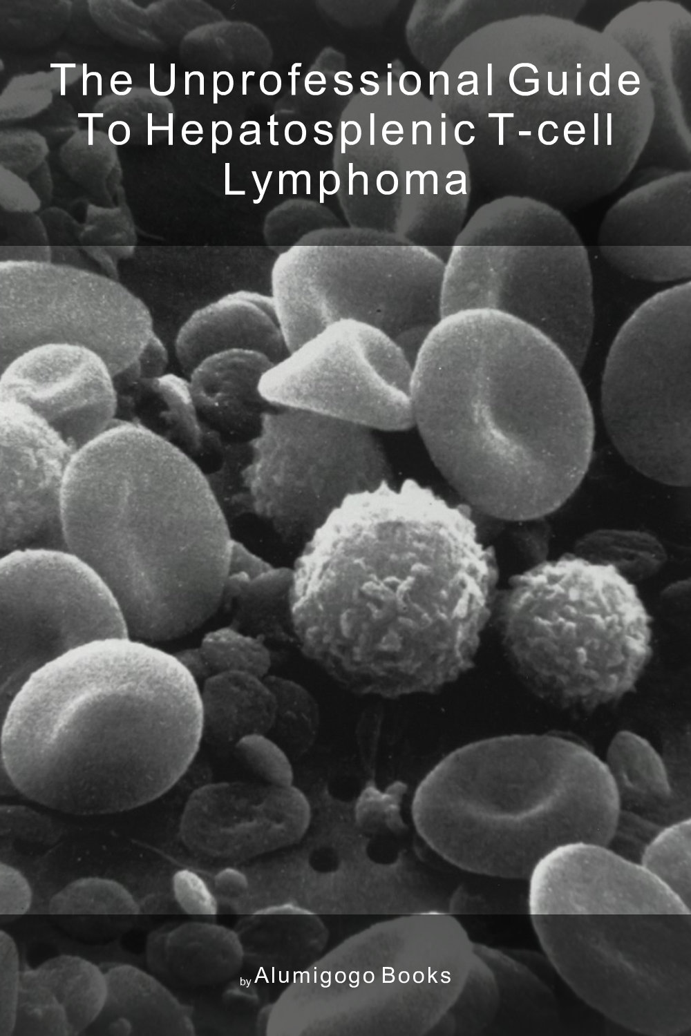 Cover of The Unprofessional Guide to hepatosplenic T-cell lymphoma