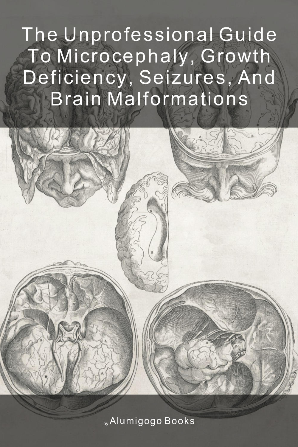 Cover of The Unprofessional Guide to microcephaly, growth deficiency, seizures, and brain malformations