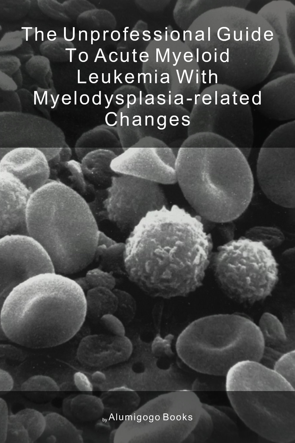 Cover of The Unprofessional Guide to acute myeloid leukemia with myelodysplasia-related changes
