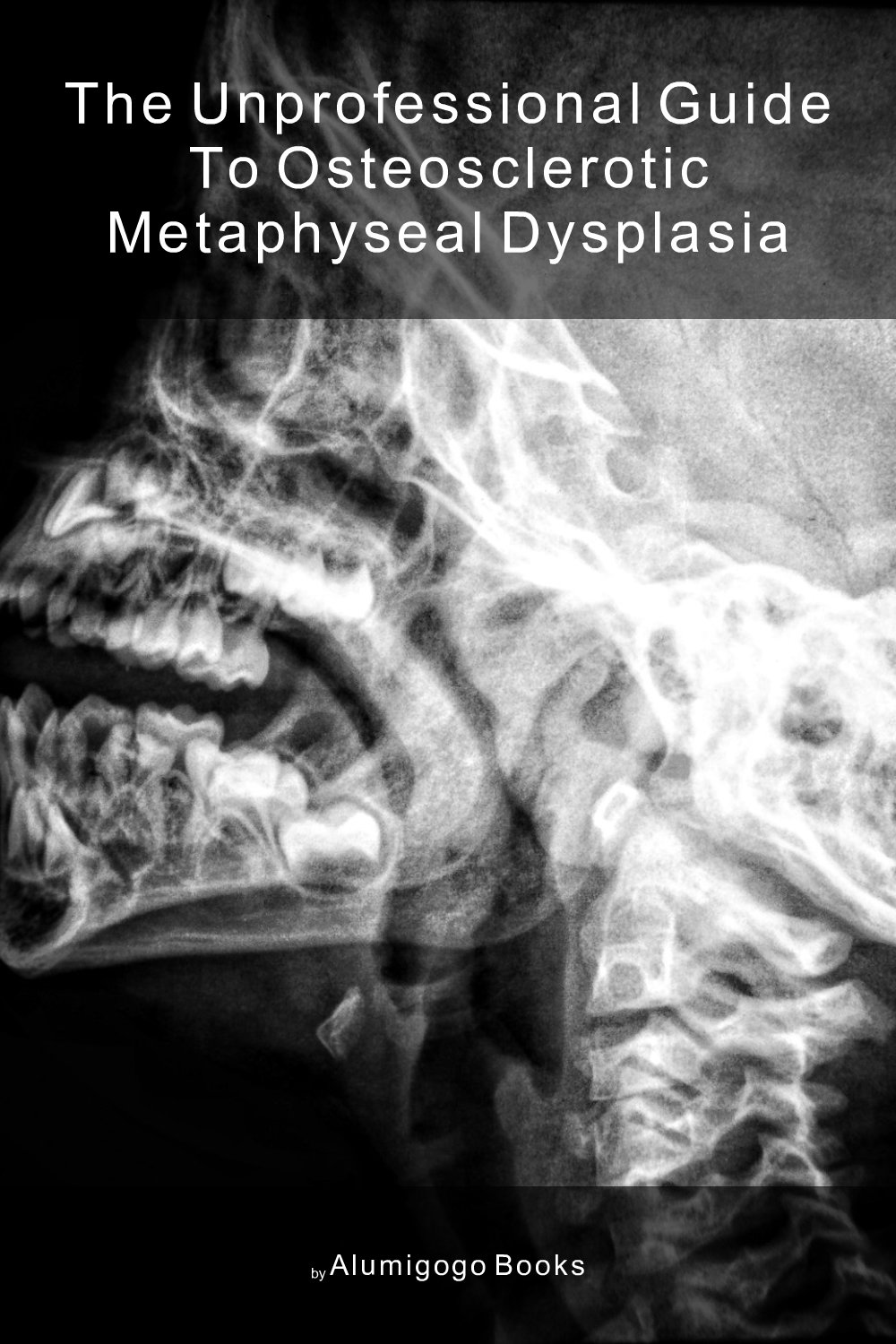 Cover of The Unprofessional Guide to osteosclerotic metaphyseal dysplasia