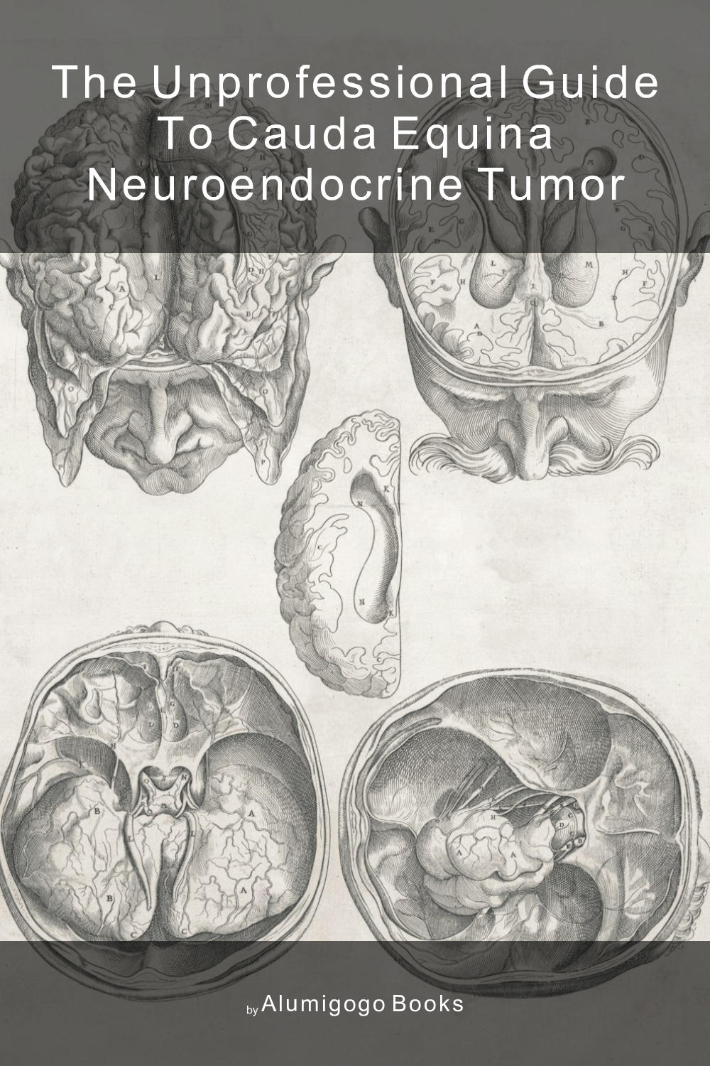 Cover of The Unprofessional Guide to cauda equina neuroendocrine tumor
