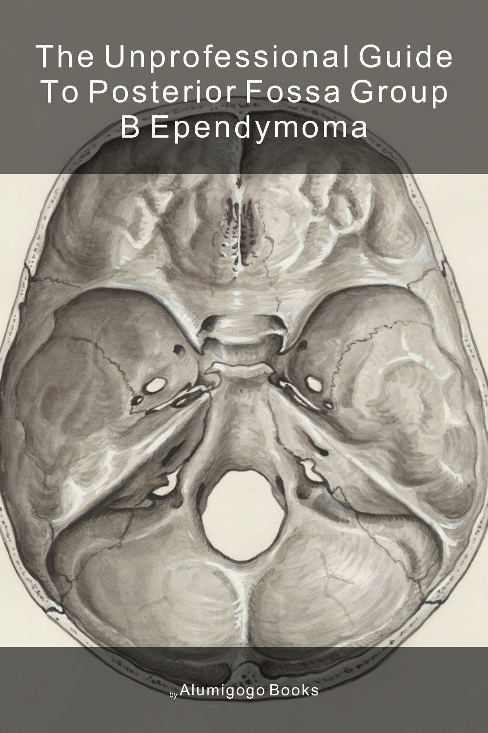 Cover of The Unprofessional Guide to posterior fossa group B ependymoma