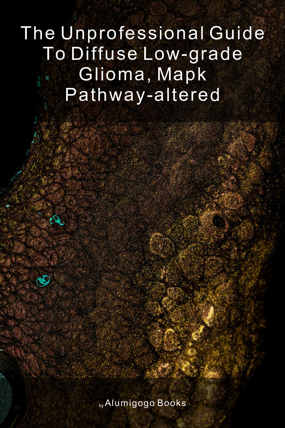 Cover of The Unprofessional Guide to diffuse low-grade glioma, MAPK pathway–altered