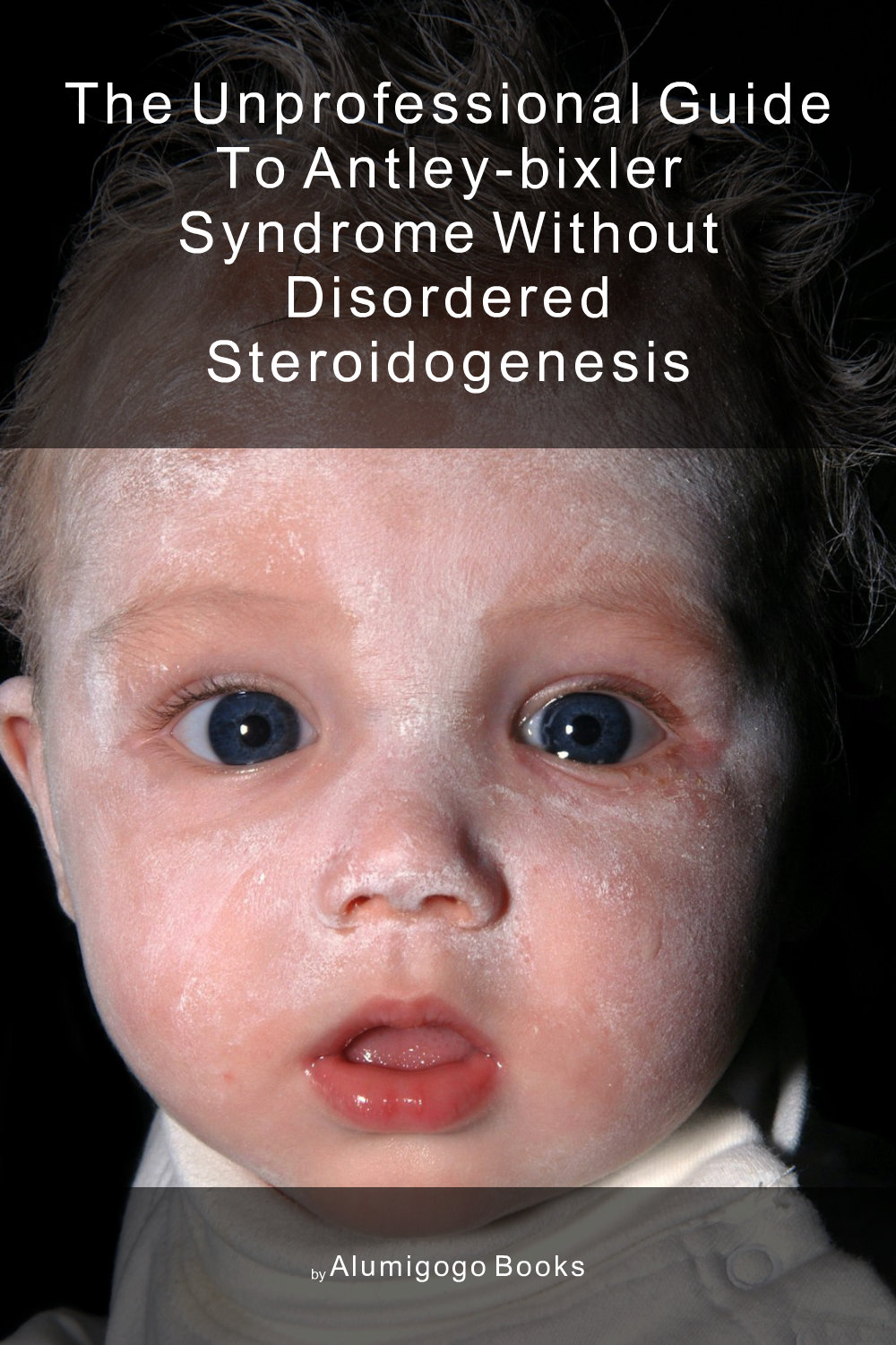 Cover of The Unprofessional Guide to Antley-Bixler syndrome without disordered steroidogenesis
