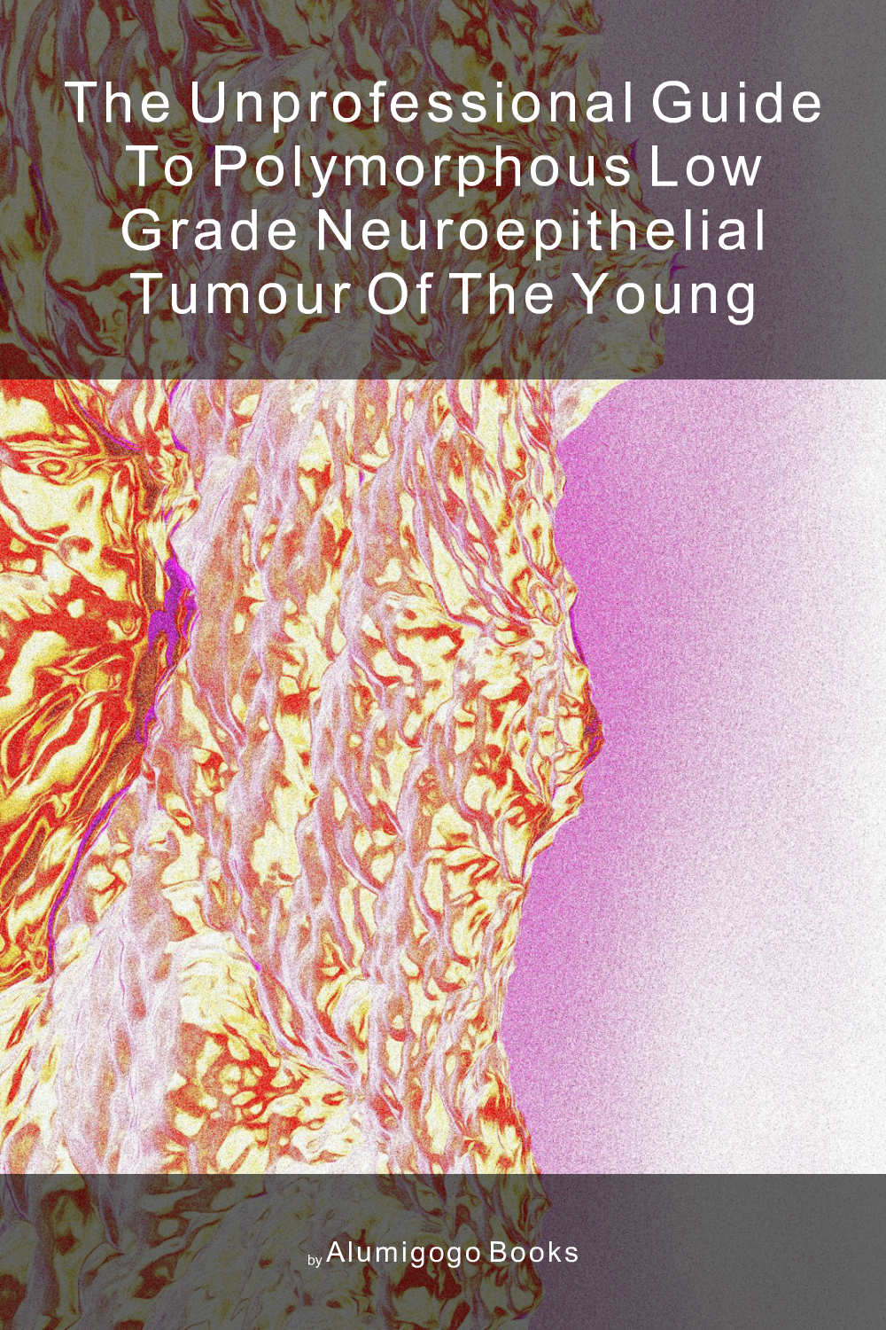Cover of The Unprofessional Guide to polymorphous low grade neuroepithelial tumour of the young