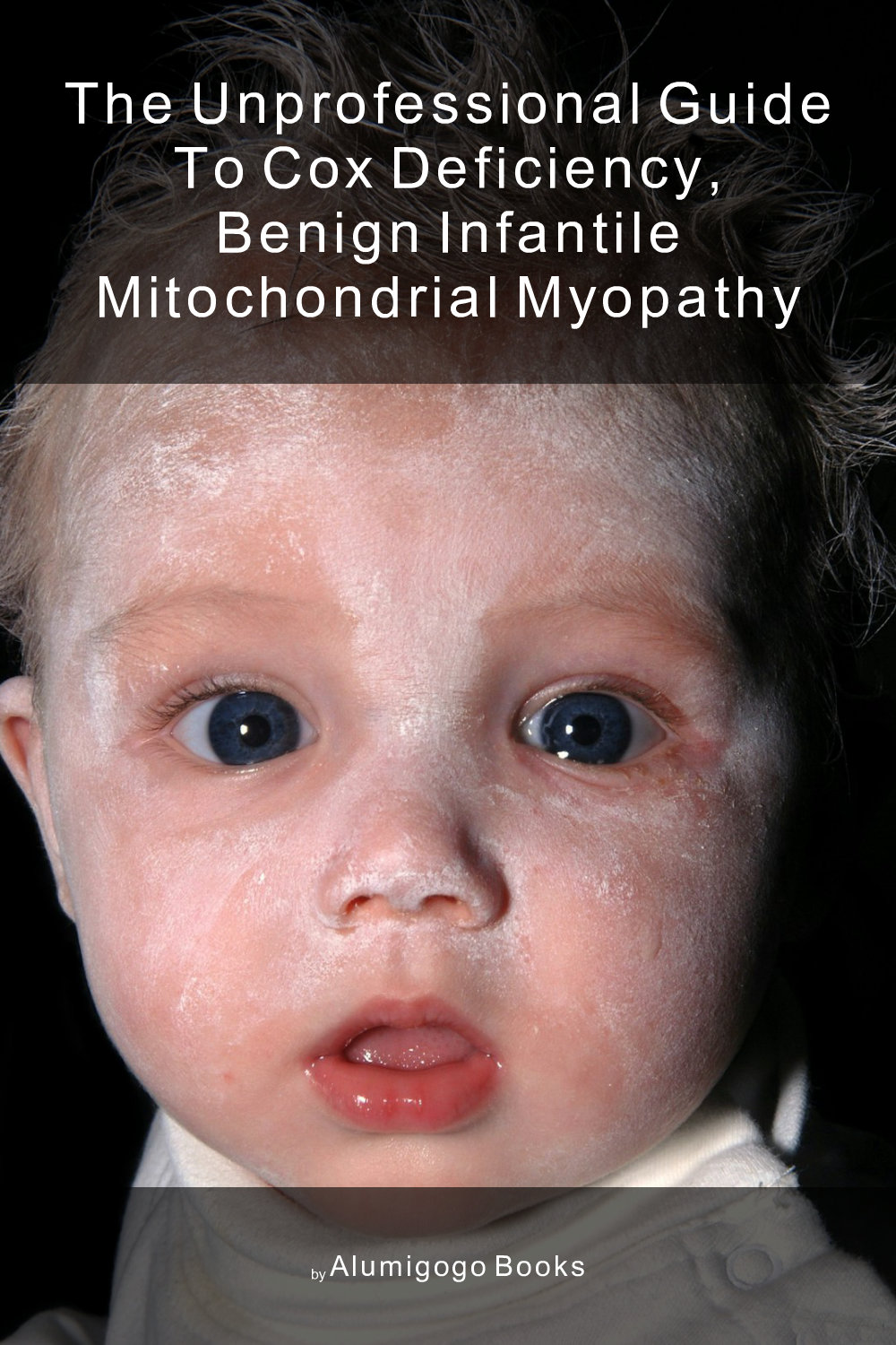 Cover of The Unprofessional Guide to COX deficiency, benign infantile mitochondrial myopathy