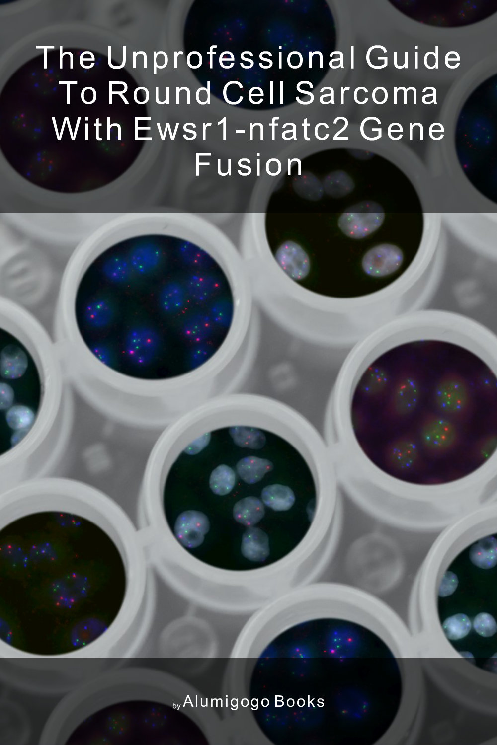 Cover of The Unprofessional Guide to round cell sarcoma with EWSR1-NFATC2 gene fusion