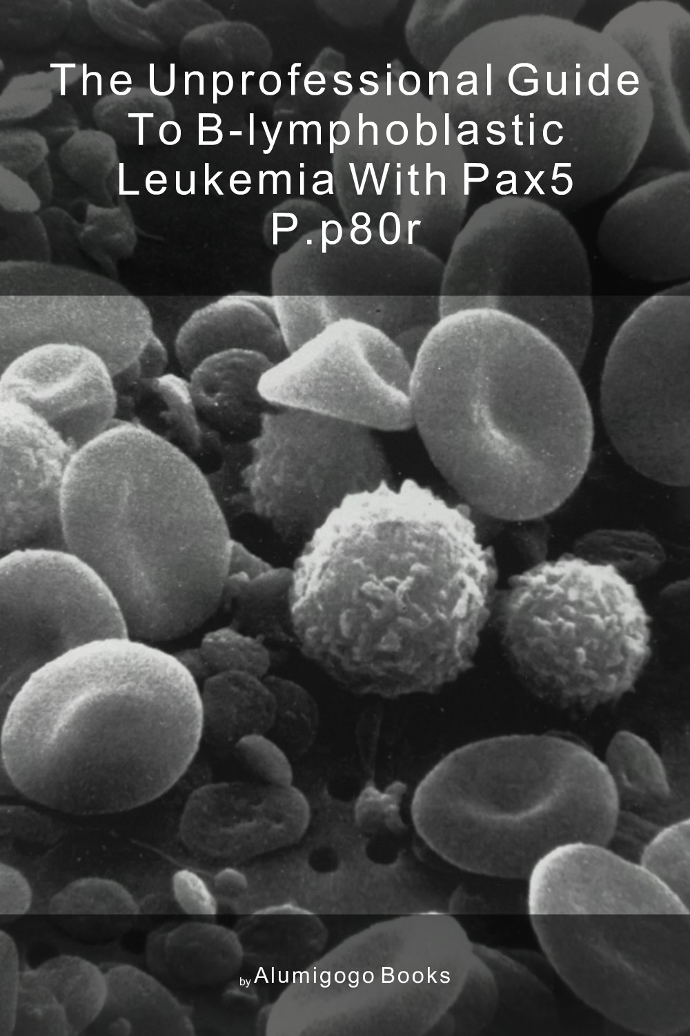 Cover of The Unprofessional Guide to B-lymphoblastic leukemia with PAX5 p.P80R