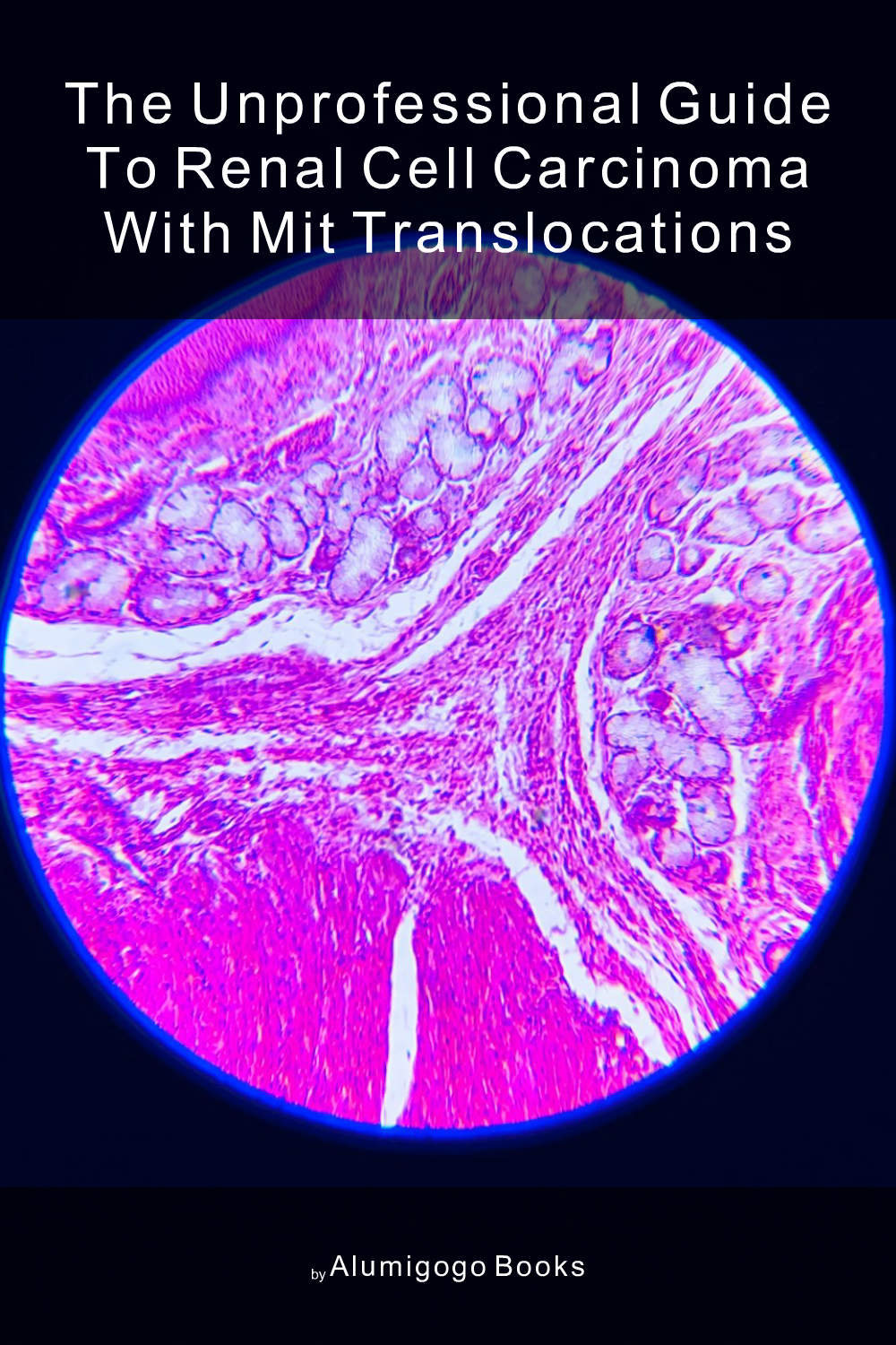 Cover of The Unprofessional Guide to renal cell carcinoma with MiT translocations