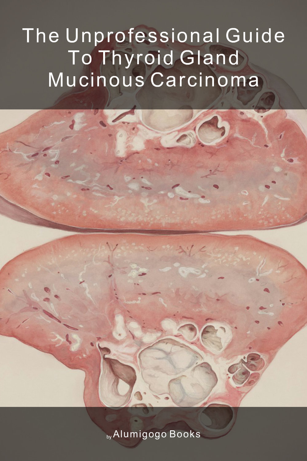 Cover of The Unprofessional Guide to thyroid gland mucinous carcinoma