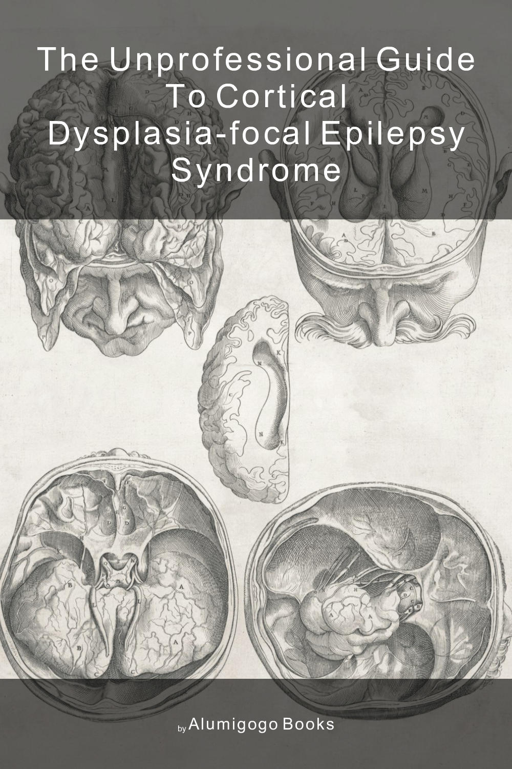 Cover of The Unprofessional Guide to cortical dysplasia-focal epilepsy syndrome