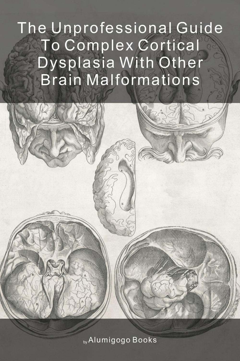 Cover of The Unprofessional Guide to complex cortical dysplasia with other brain malformations