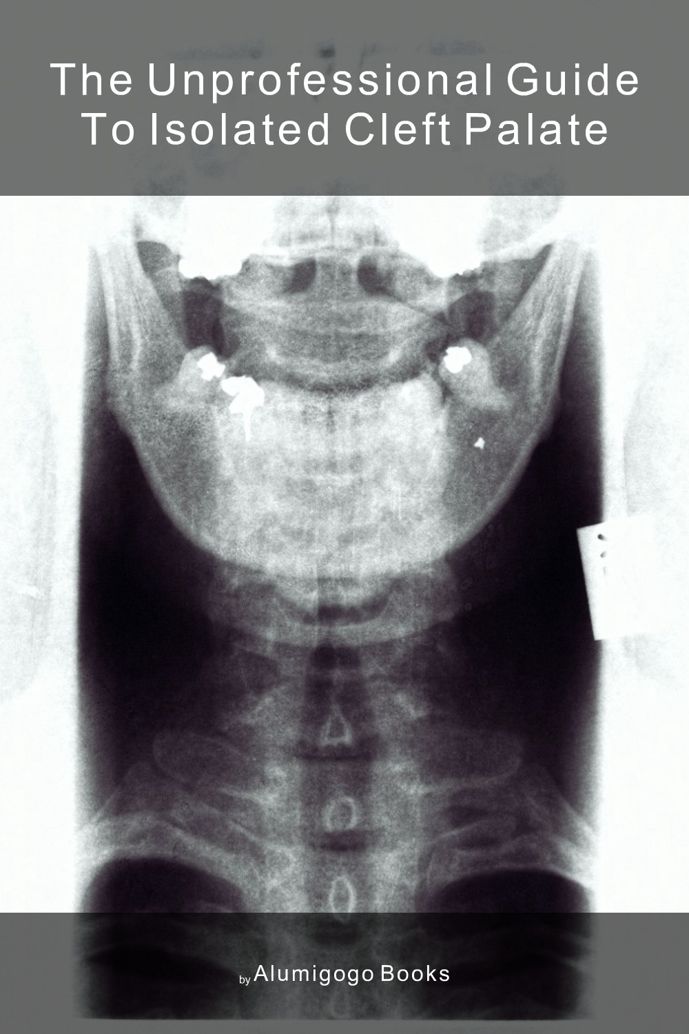 Cover of The Unprofessional Guide to isolated cleft palate