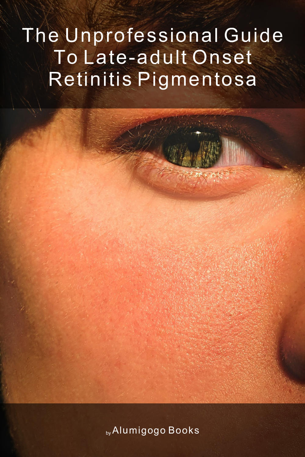 Cover of The Unprofessional Guide to late-adult onset retinitis pigmentosa