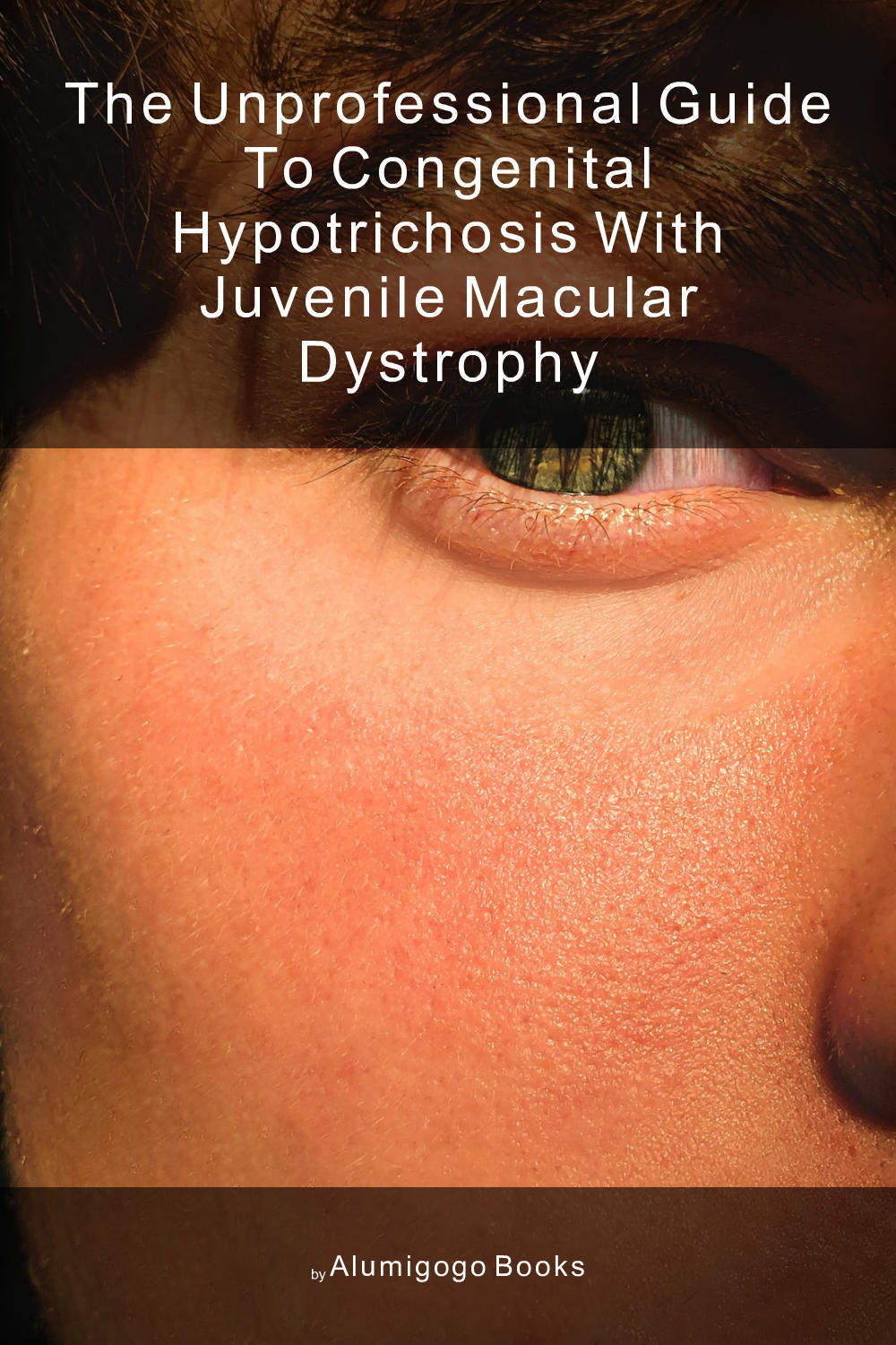 Cover of The Unprofessional Guide to congenital hypotrichosis with juvenile macular dystrophy