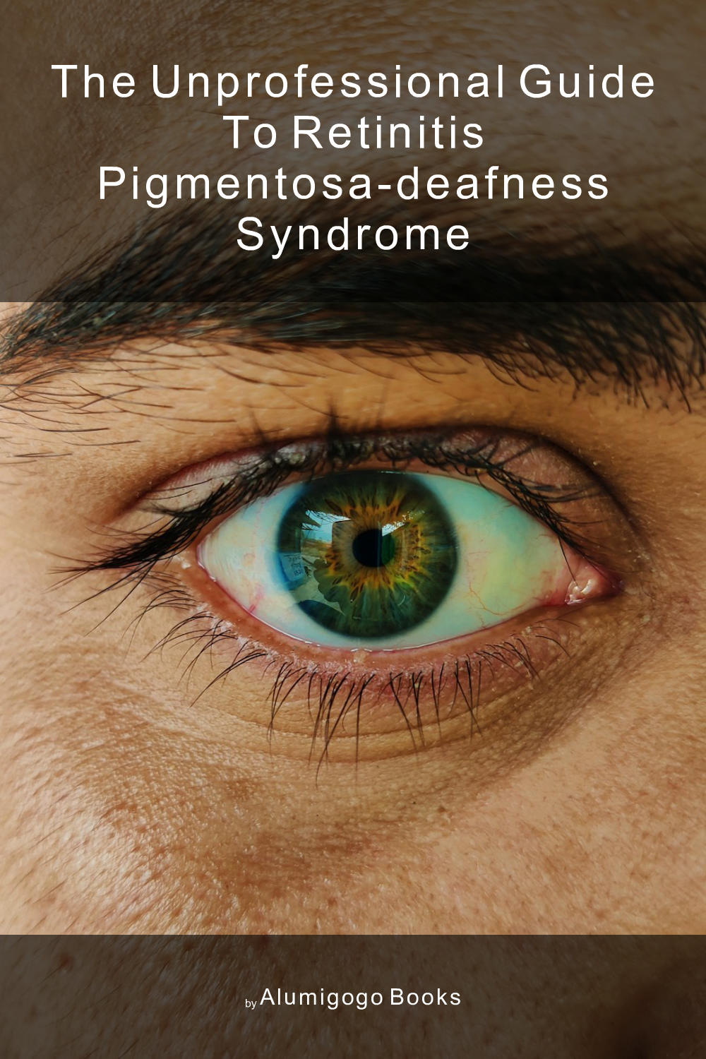 Cover of The Unprofessional Guide to retinitis pigmentosa-deafness syndrome