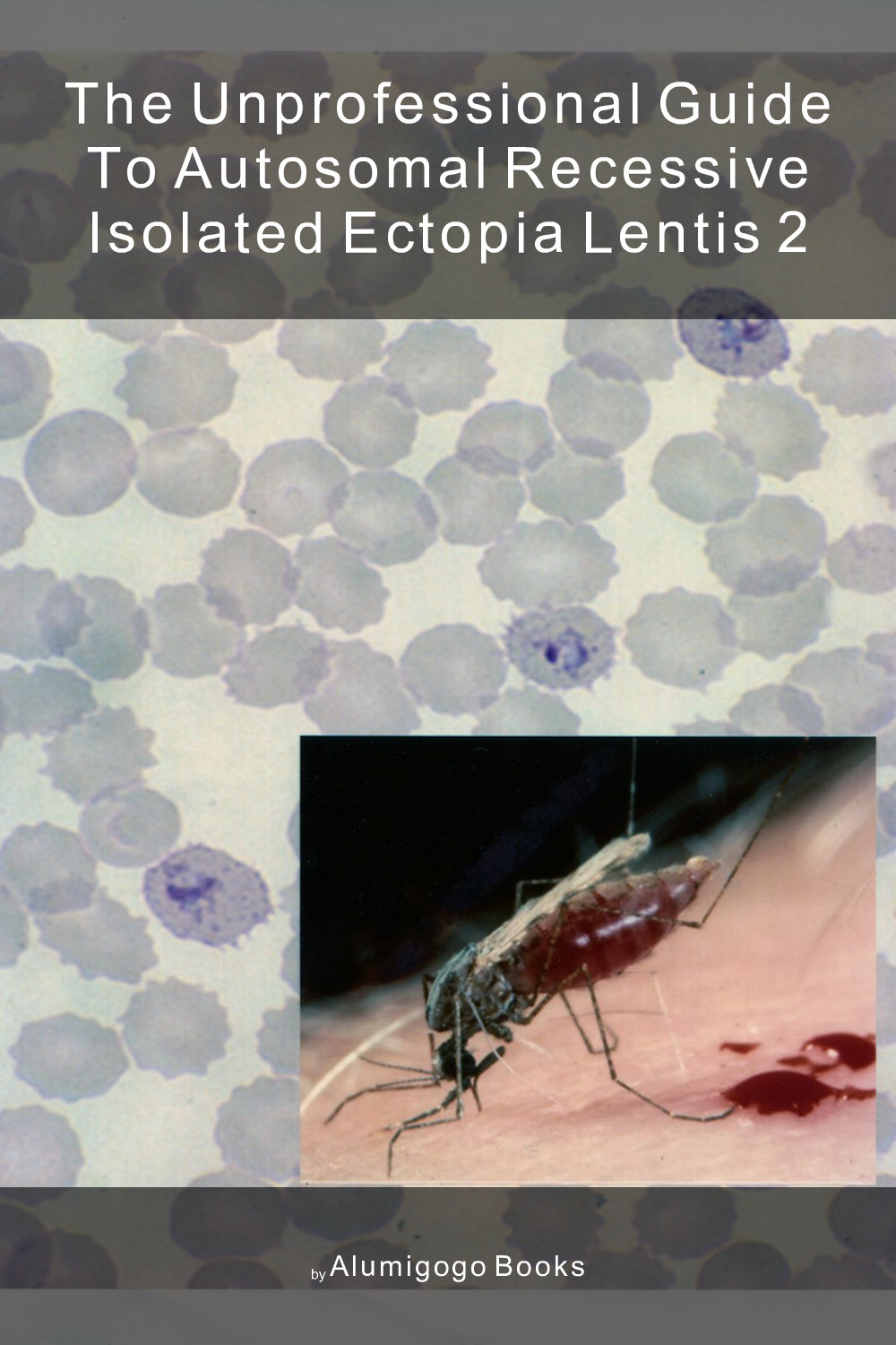 Cover of The Unprofessional Guide to autosomal recessive isolated ectopia lentis 2