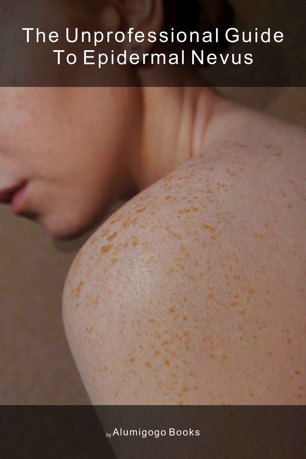 Cover of The Unprofessional Guide to epidermal nevus