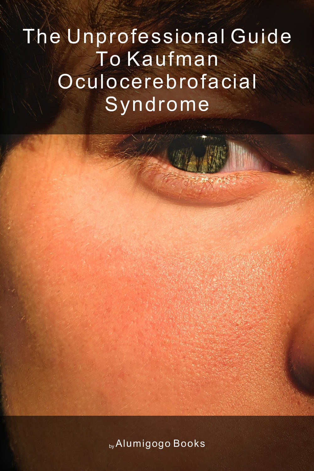 Cover of The Unprofessional Guide to Kaufman oculocerebrofacial syndrome