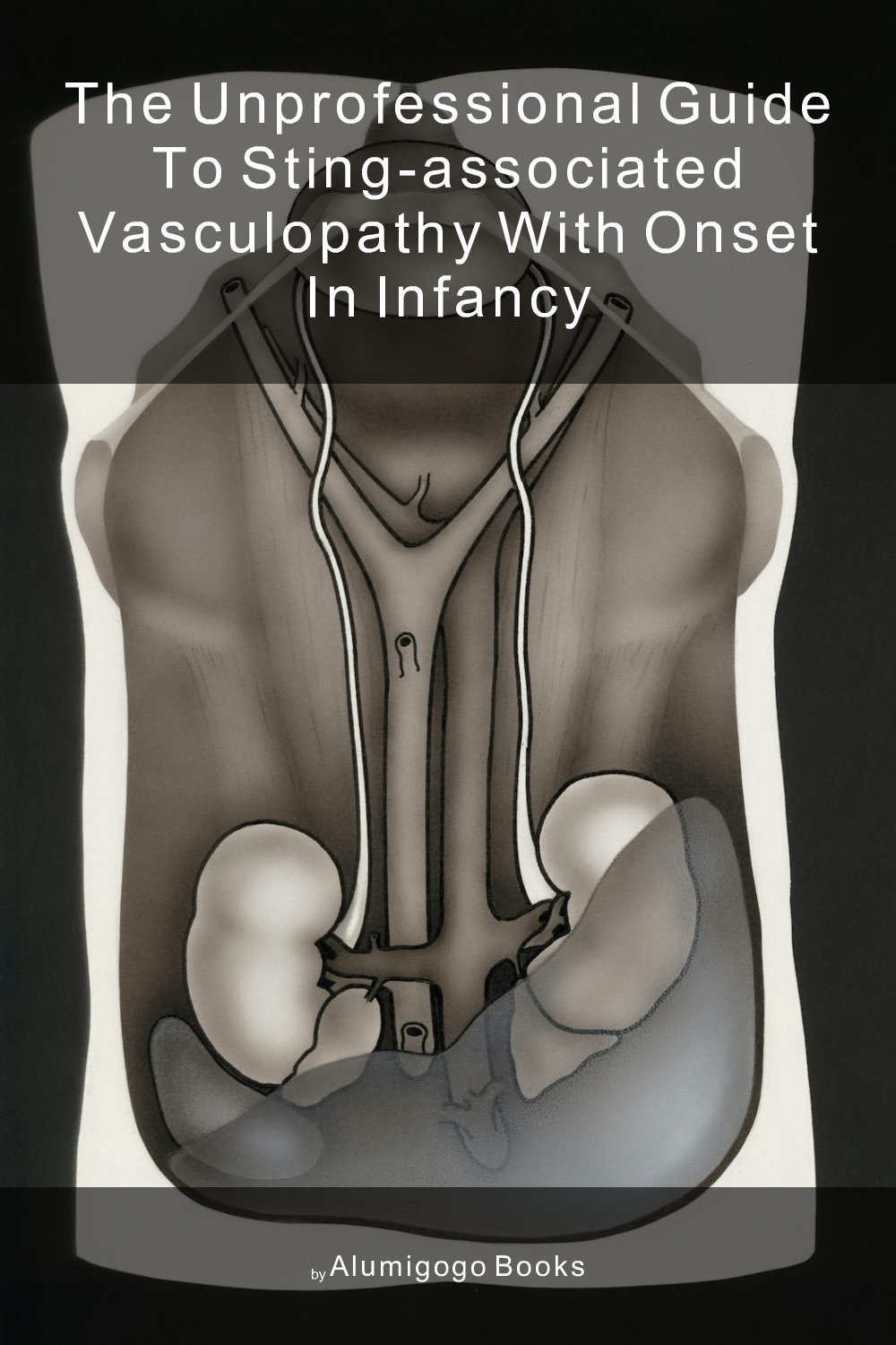 Cover of The Unprofessional Guide to STING-associated vasculopathy with onset in infancy