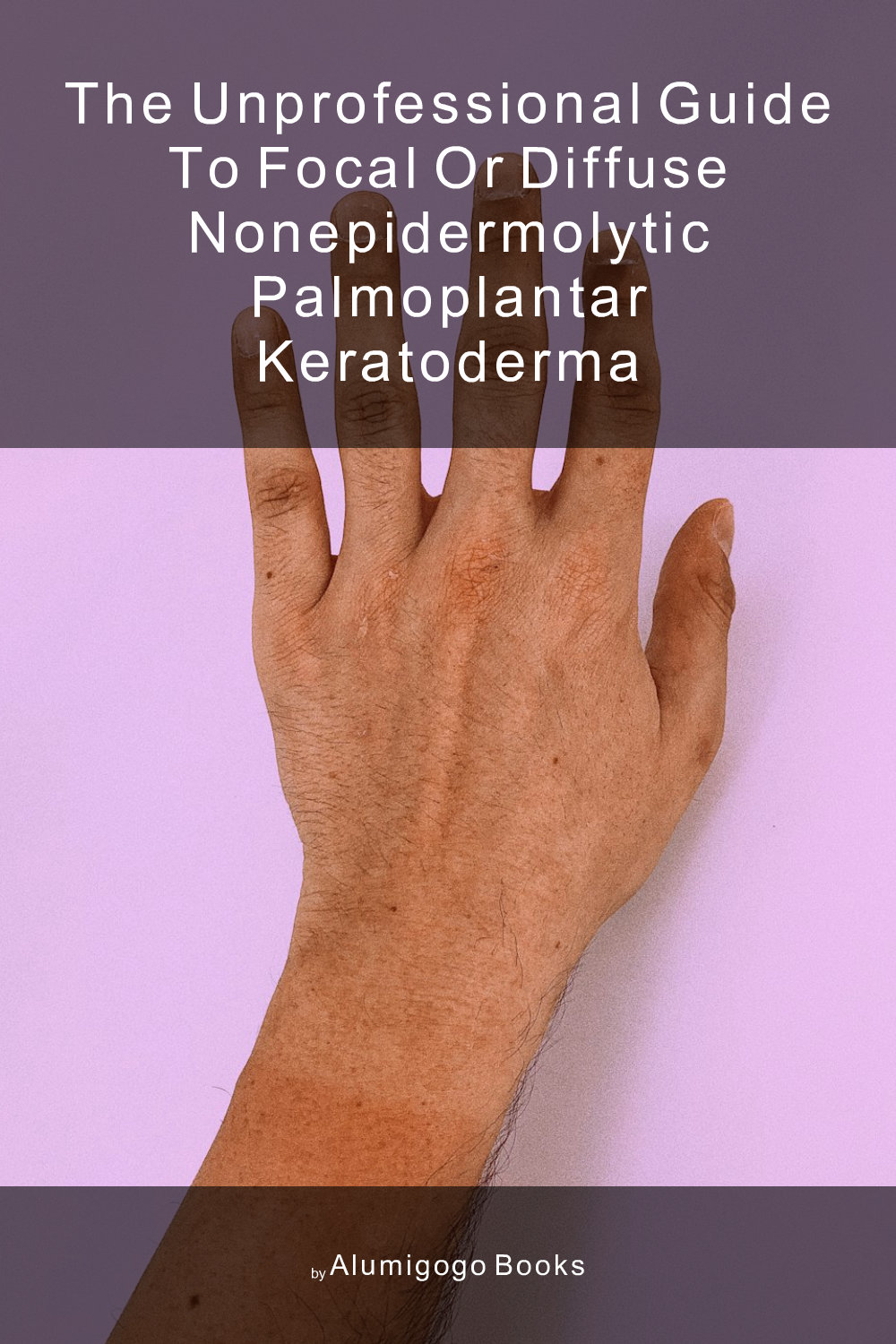 Cover of The Unprofessional Guide to focal or diffuse nonepidermolytic palmoplantar keratoderma