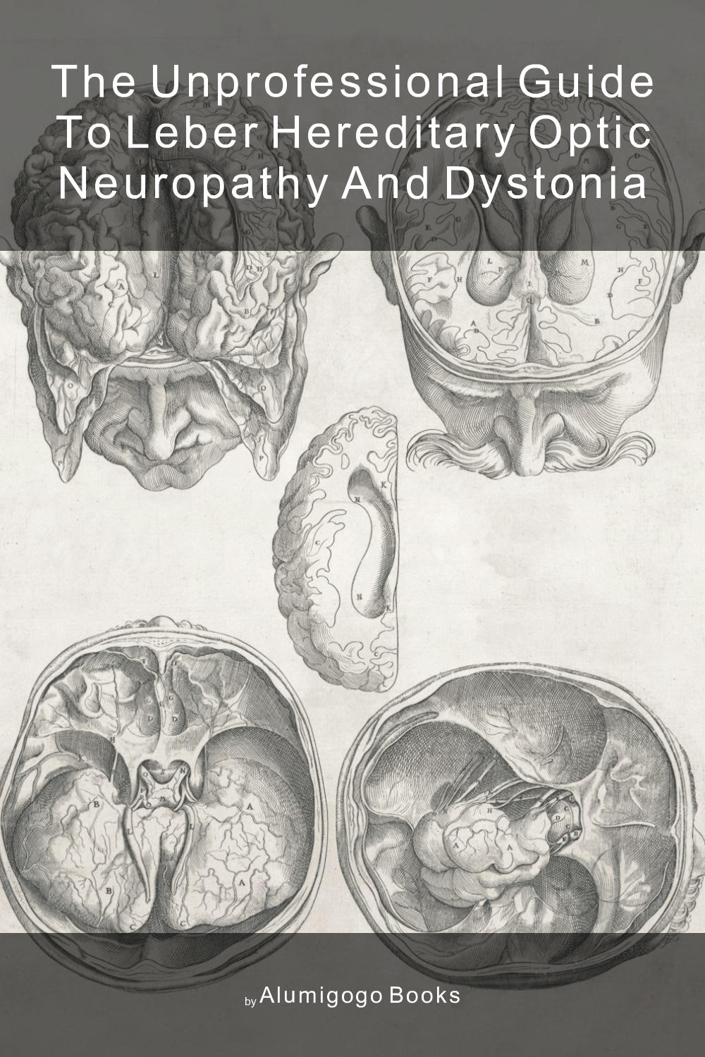Cover of The Unprofessional Guide to Leber hereditary optic neuropathy and dystonia