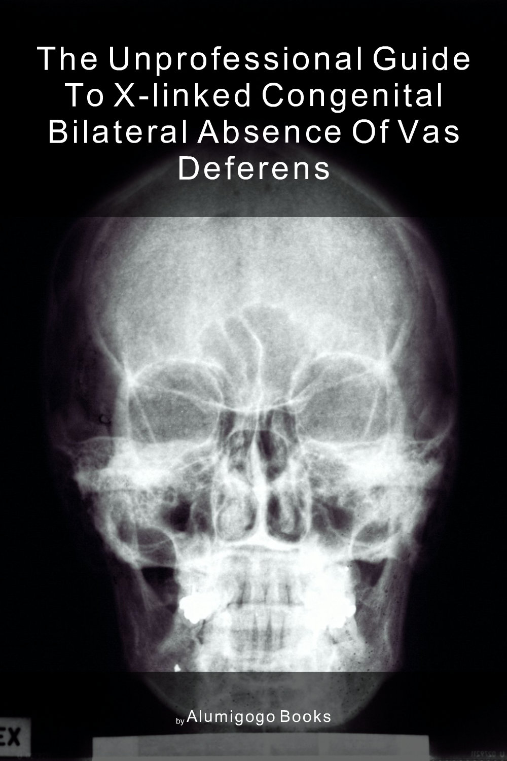 Cover of The Unprofessional Guide to X-linked congenital bilateral absence of vas deferens