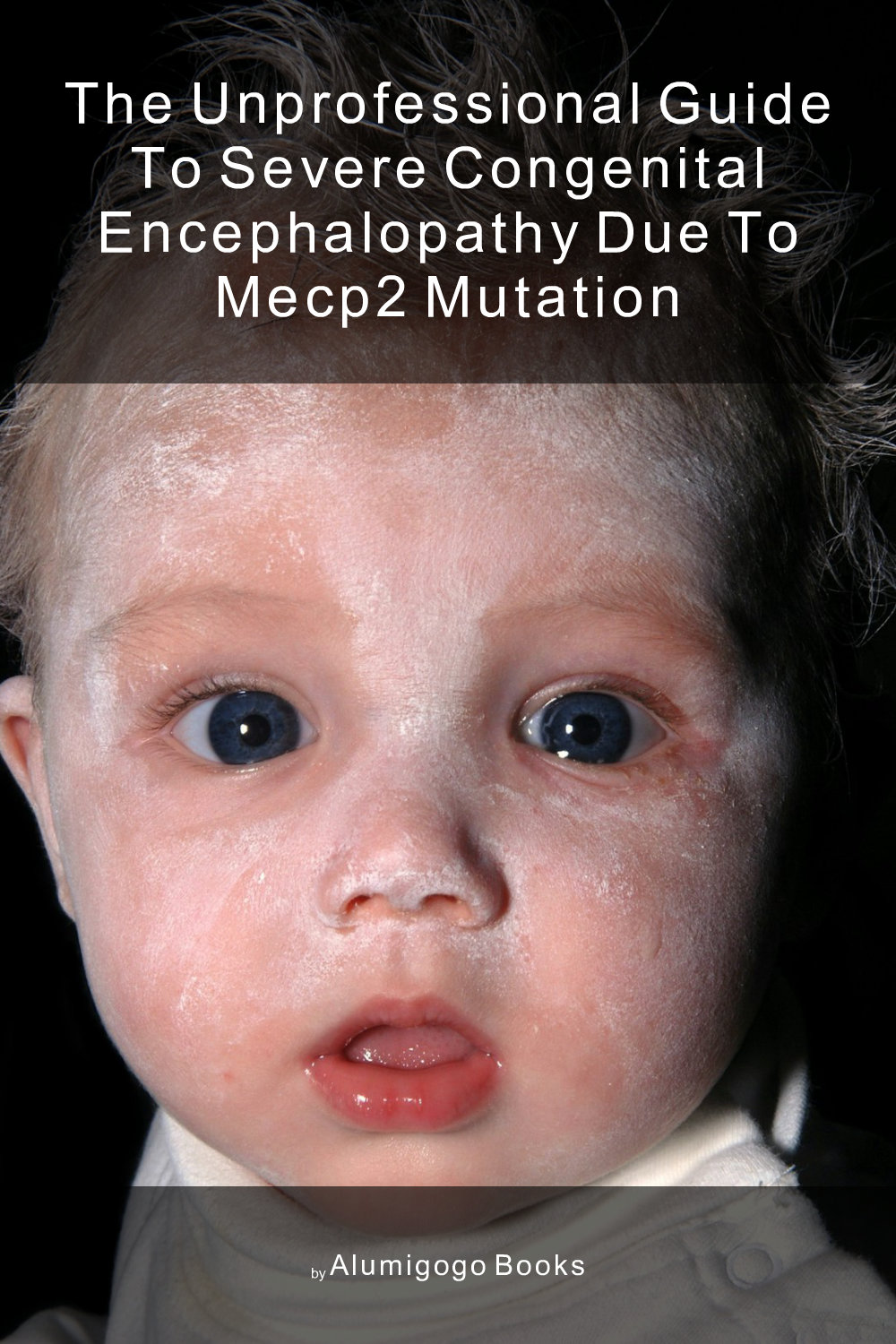 Cover of The Unprofessional Guide to severe congenital encephalopathy due to MECP2 mutation